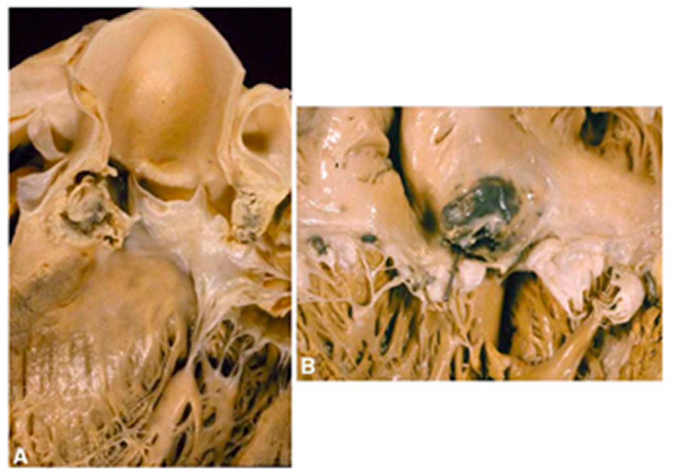 Polymers 14 03198 g001