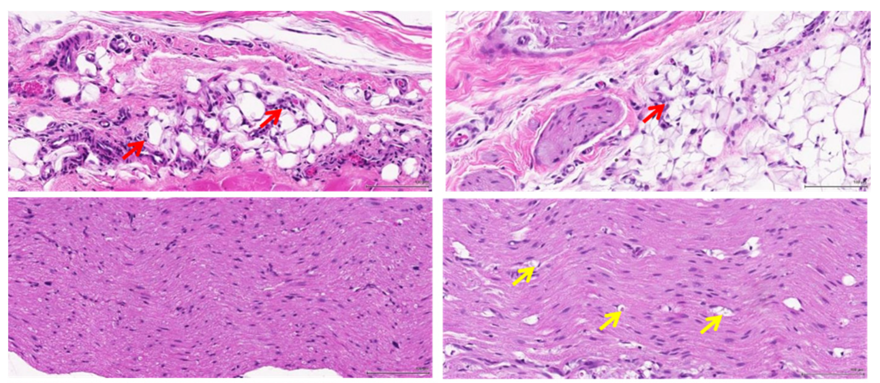 Polymers 14 04272 g008a
