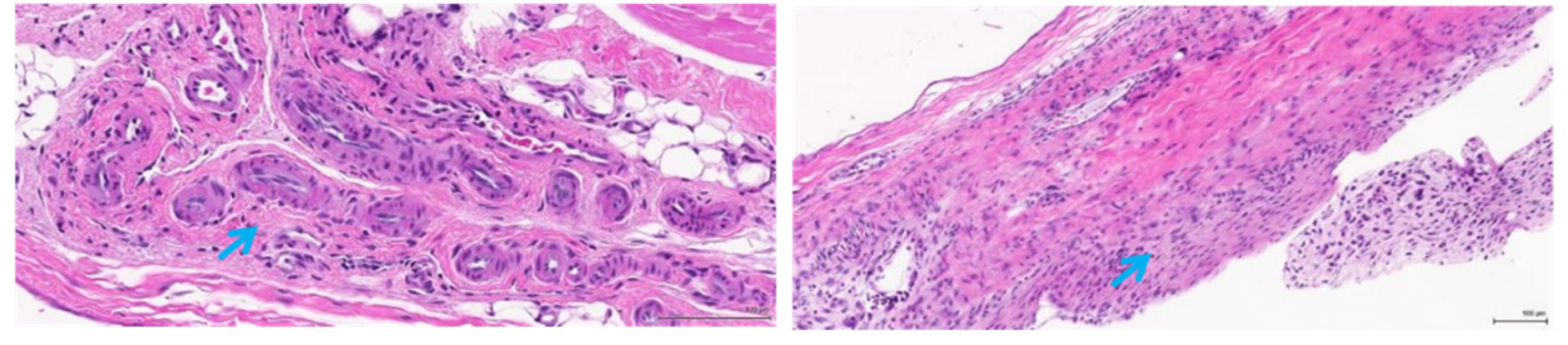 Polymers 14 04272 g008b