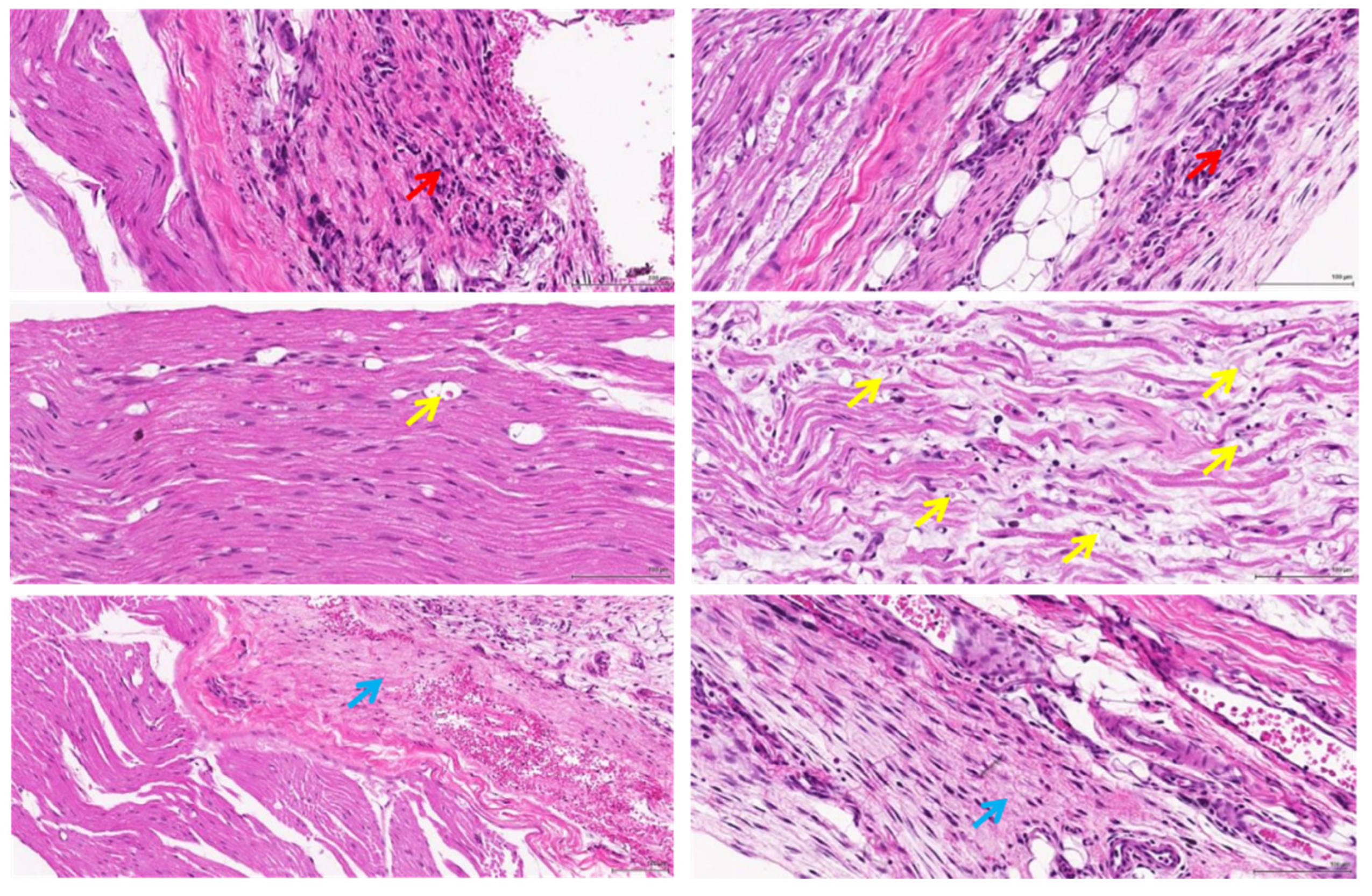 Polymers 14 04272 g009