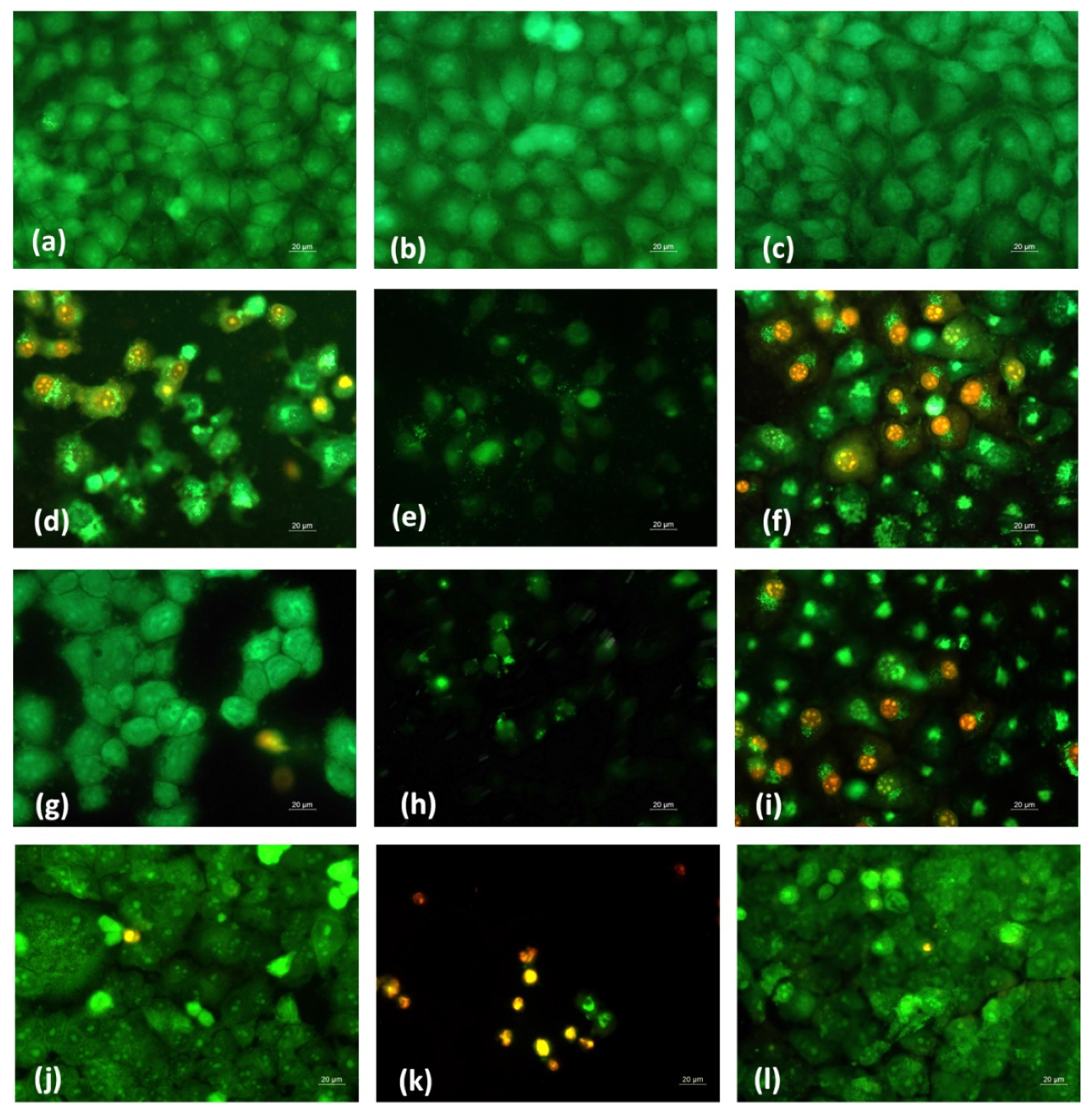 Polymers 14 05002 g012