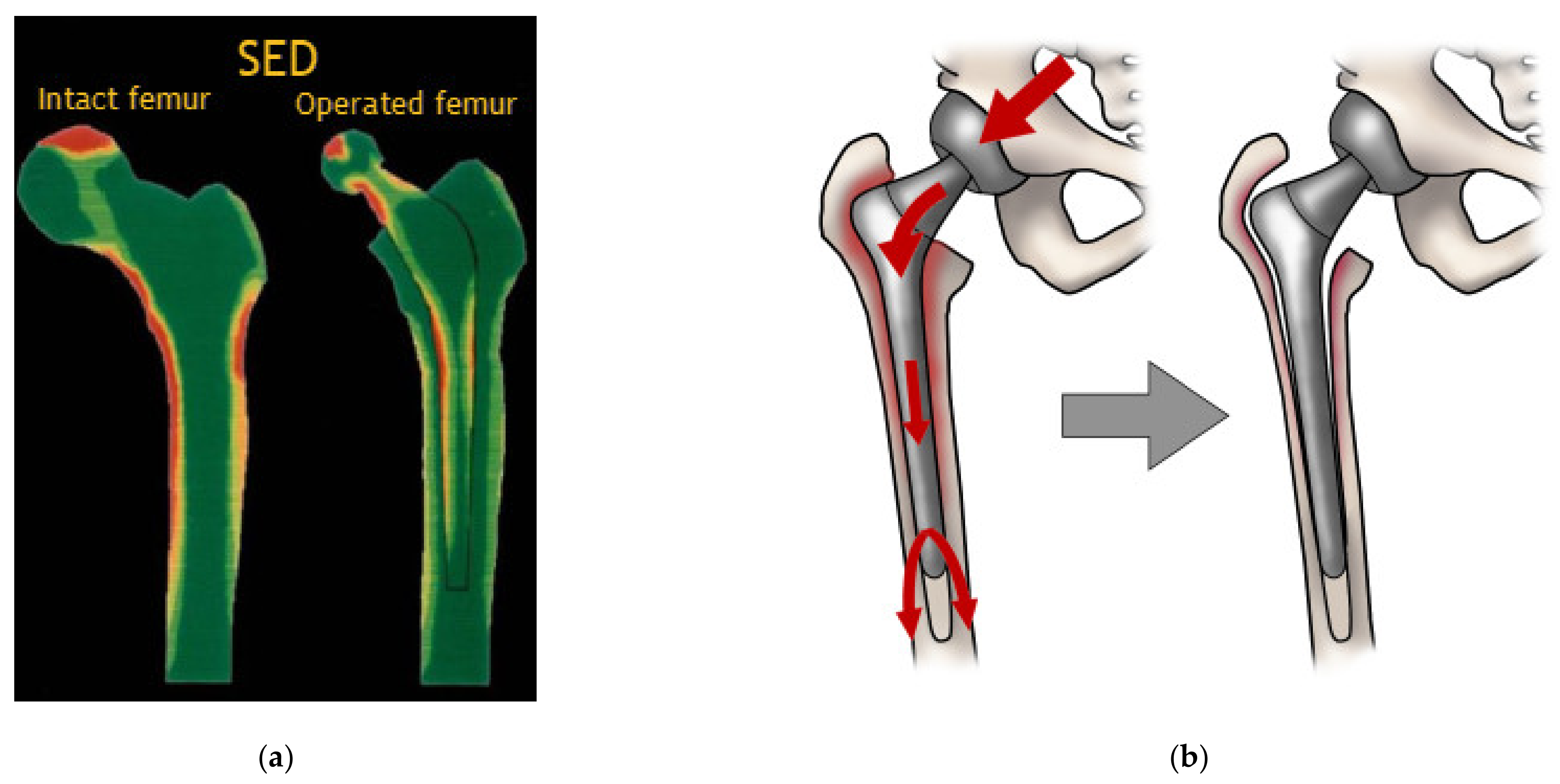 Polymers 15 00373 g003