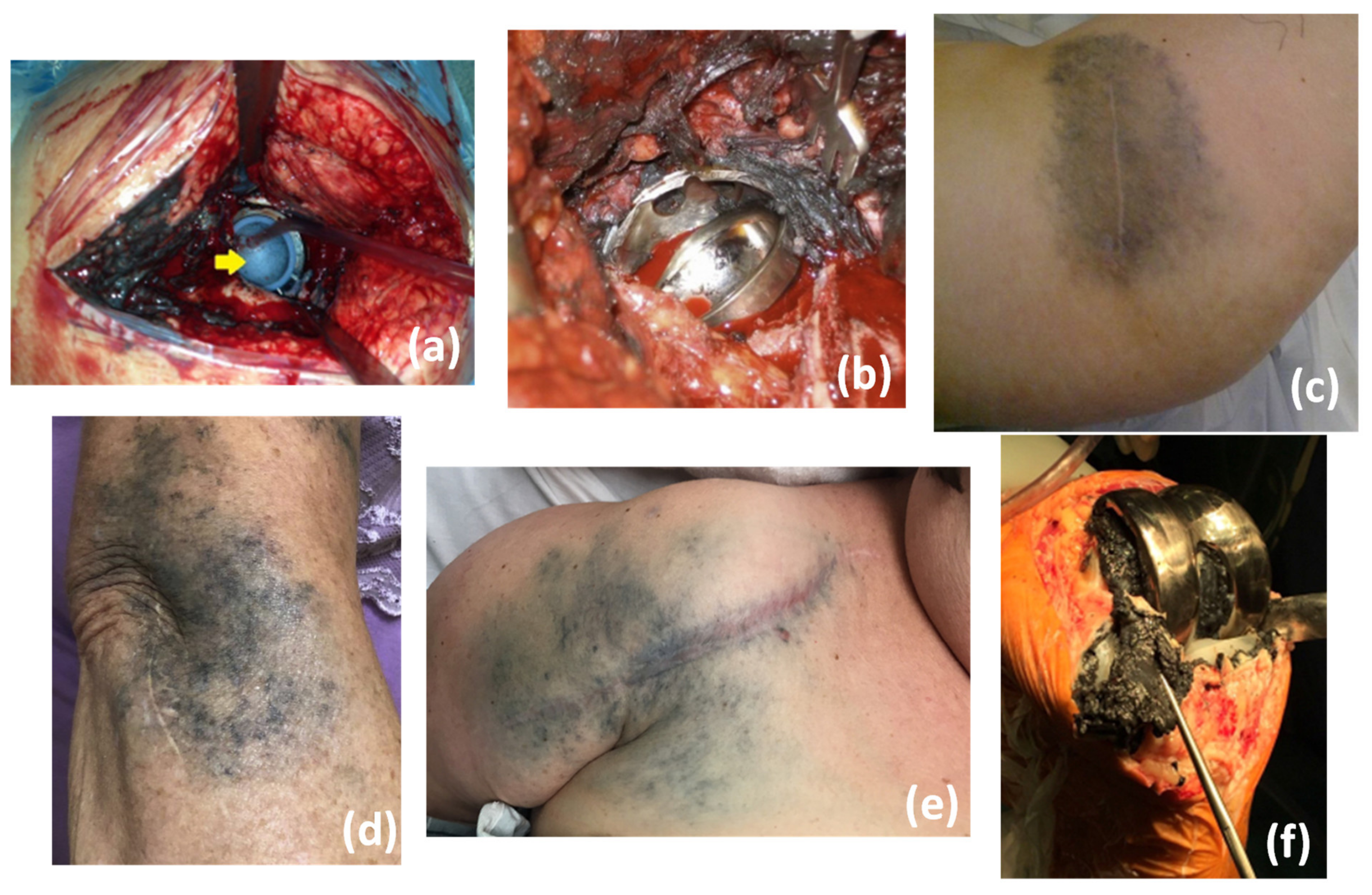 Polymers 15 00373 g005