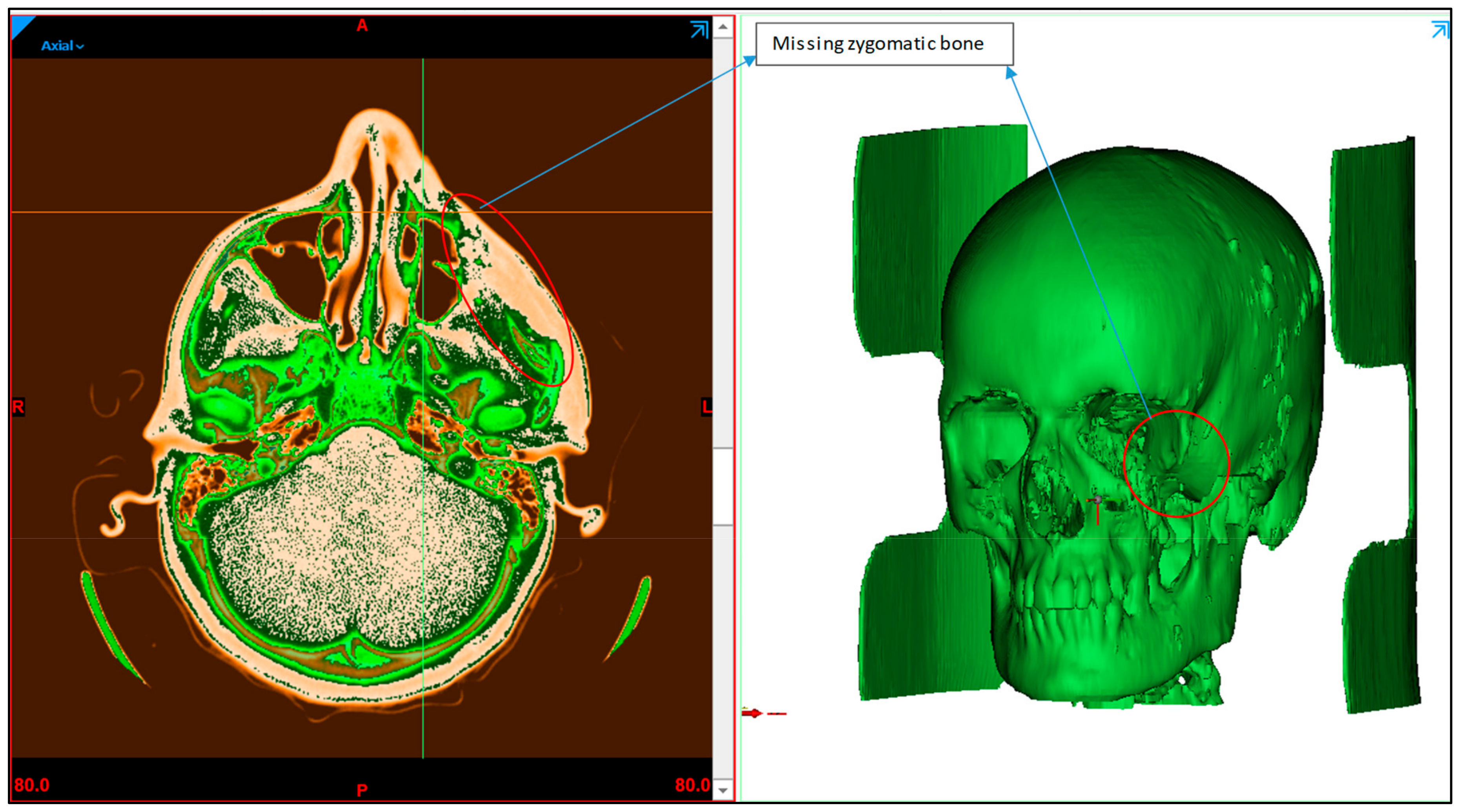 Polymers 15 00886 g002 Polymers 15 00886 g002