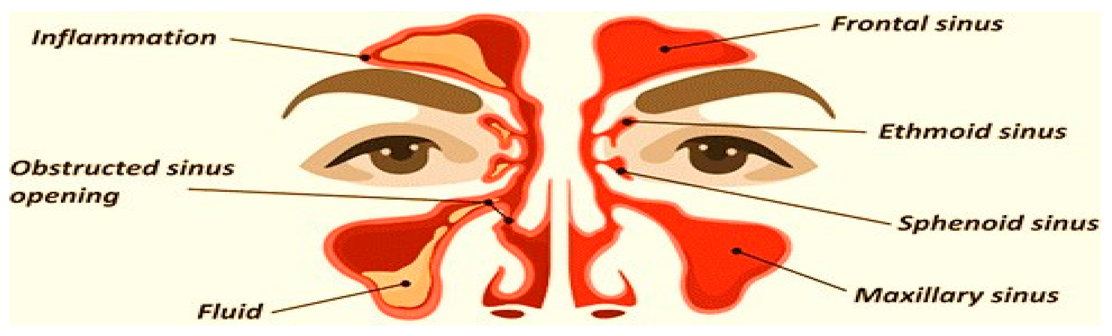 Polymers 15 02521 g001