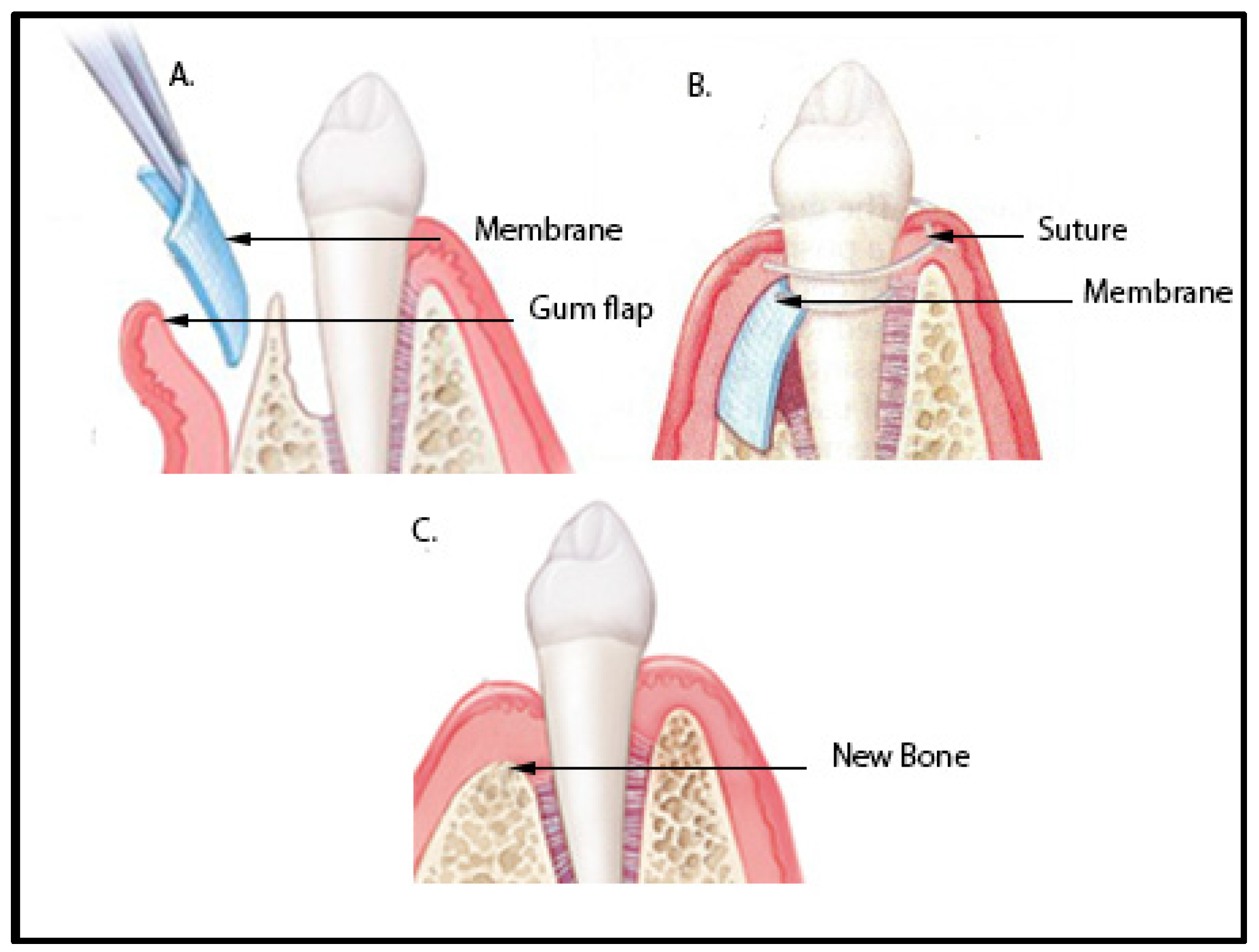 Polymers 15 03355 g003
