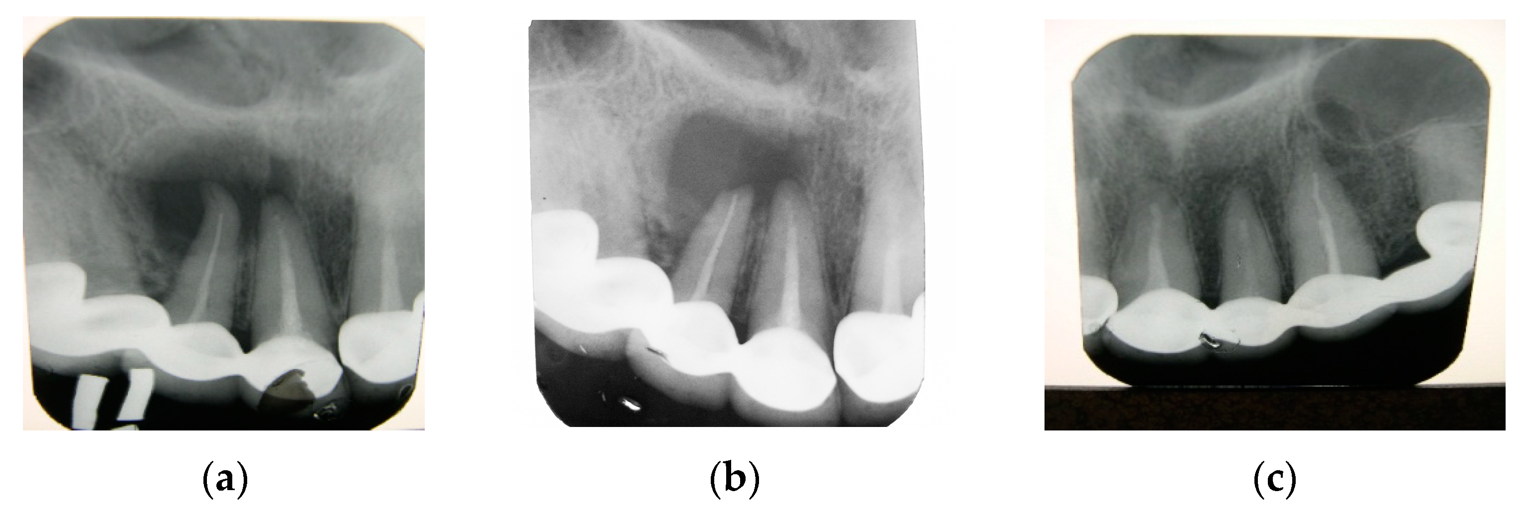 Polymers 15 04337 g008