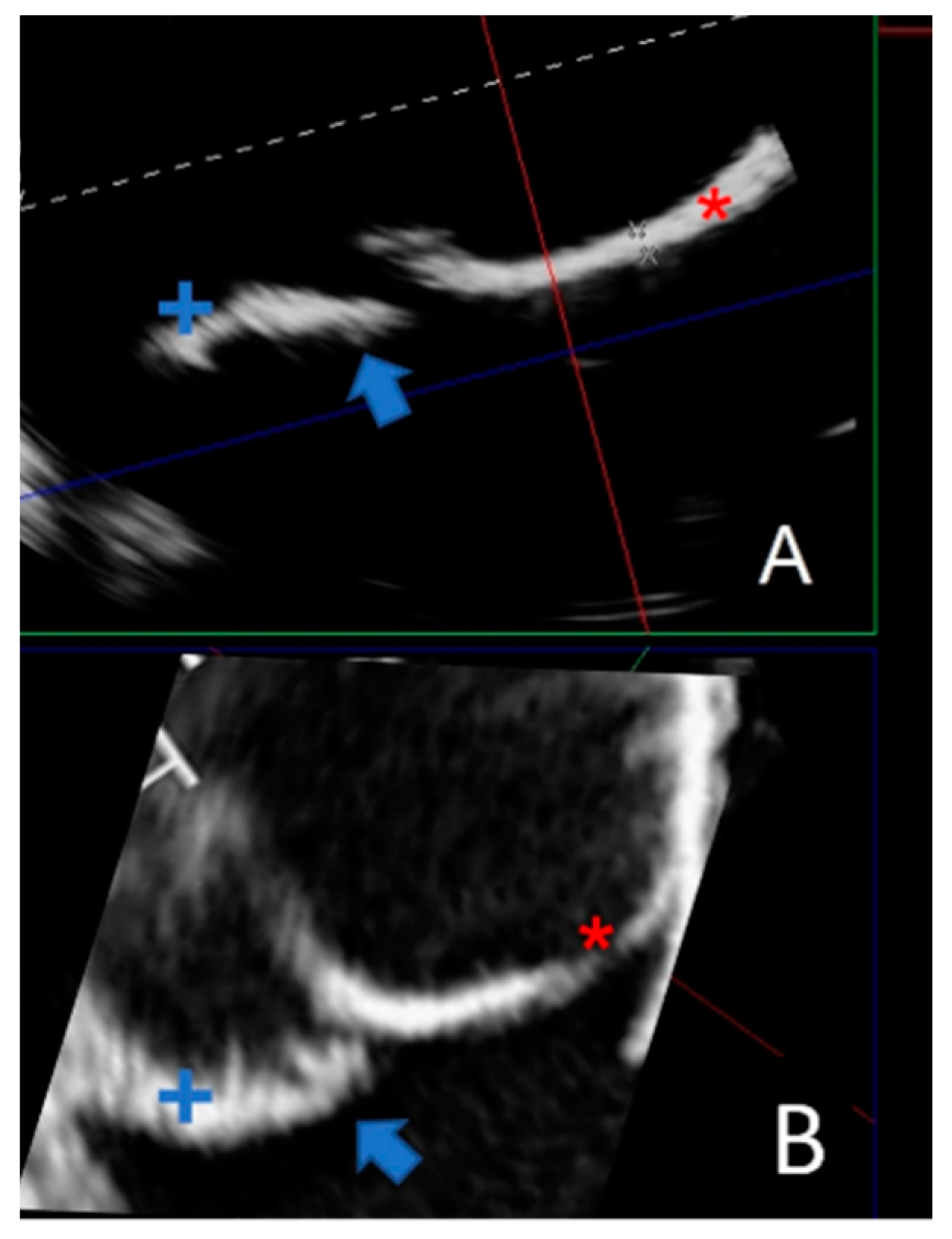 Polymers 16 00900 g010