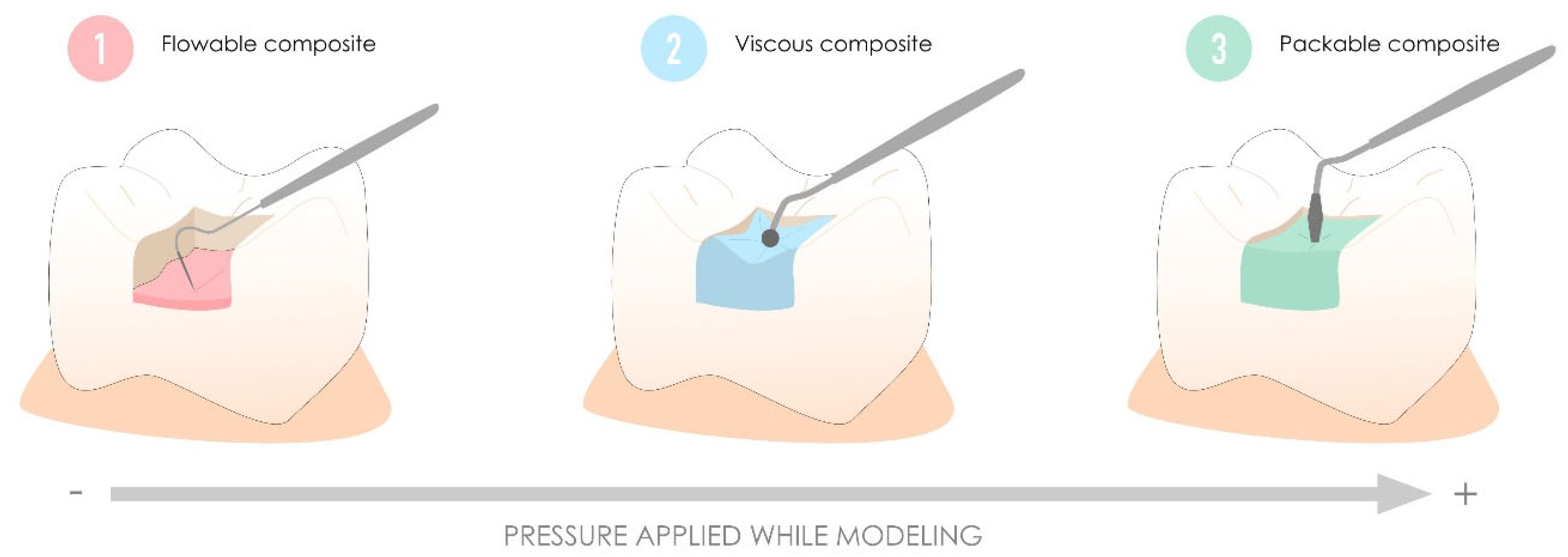 Polymers 17 00564 g004