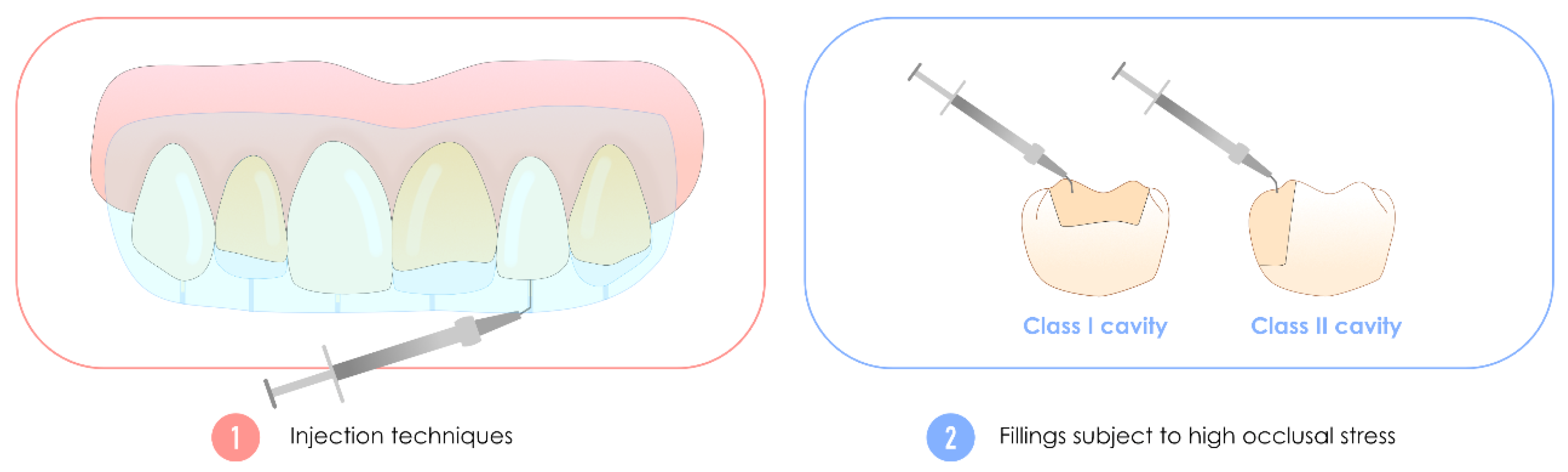 Polymers 17 00564 g011