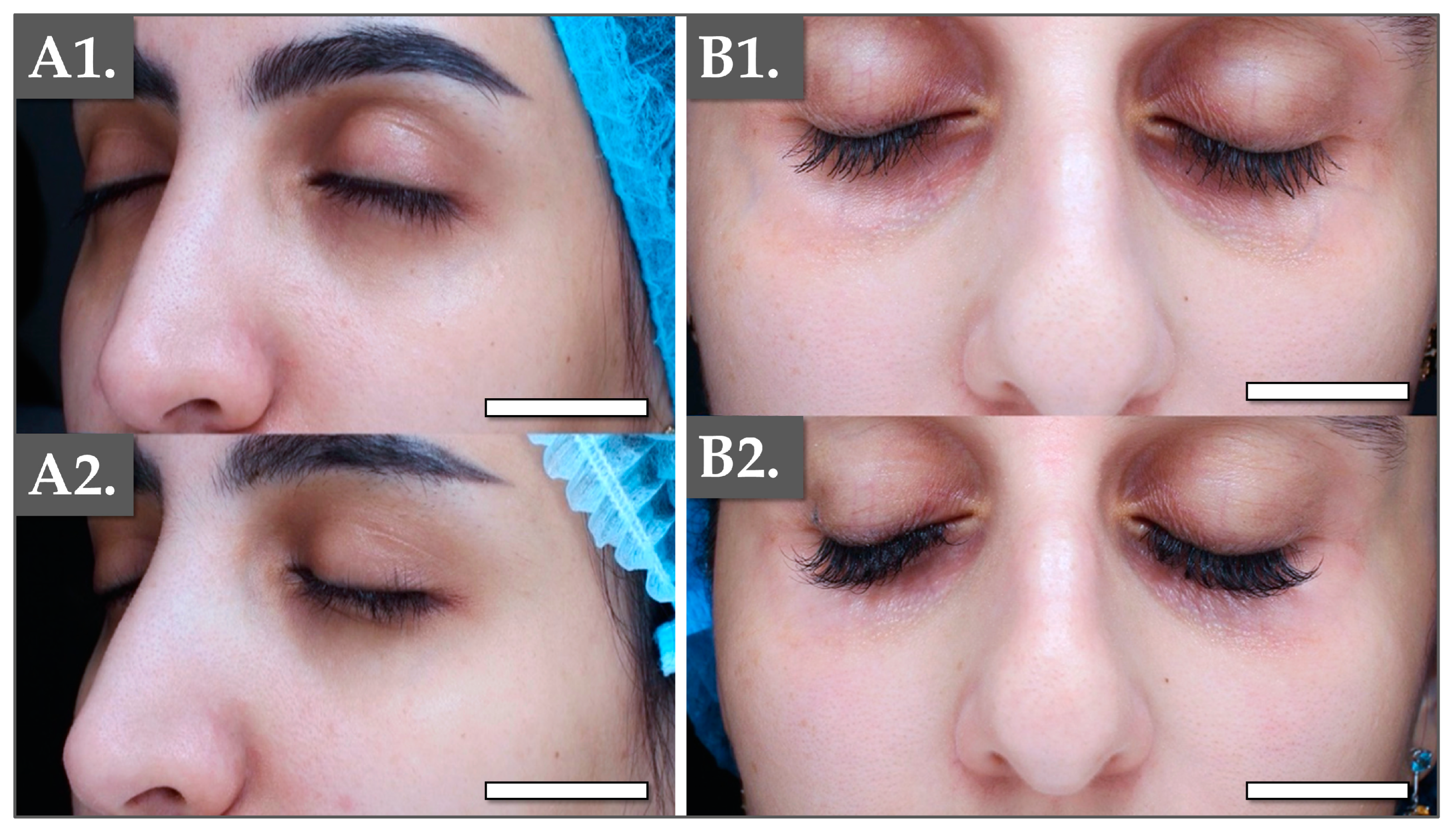 Polymers 17 00638 g005