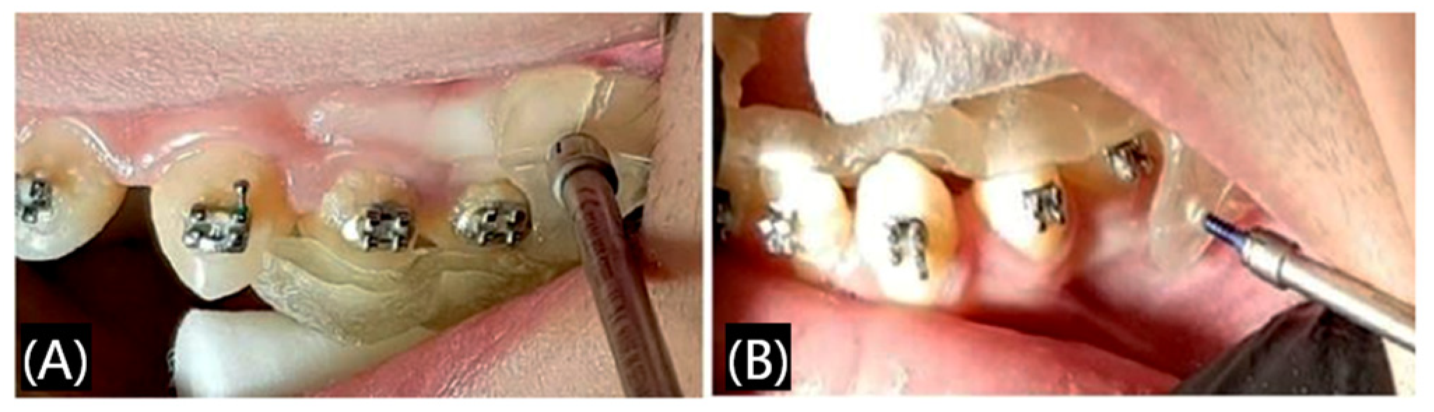 Polymers 17 00886 g003