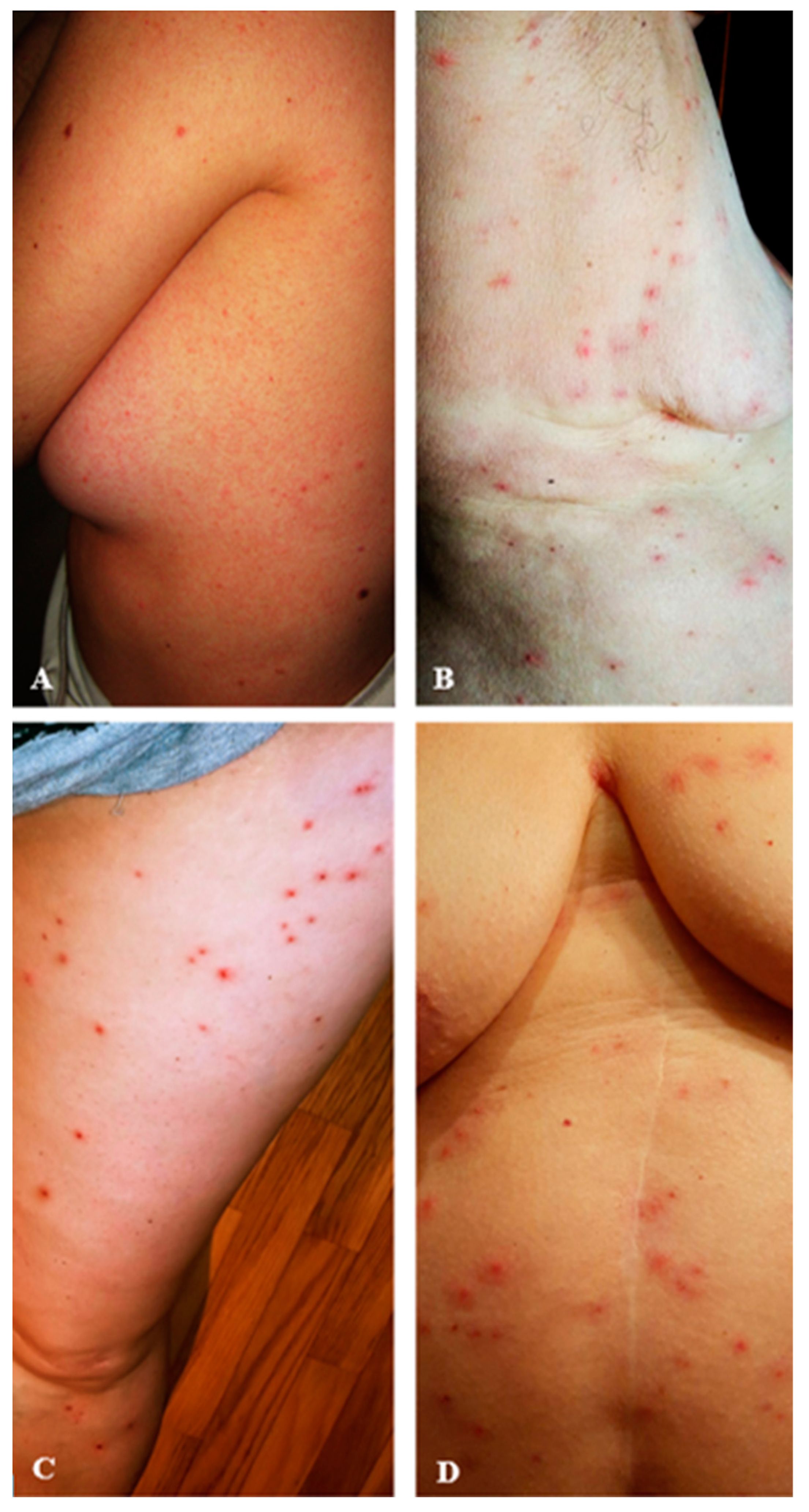 Poultry 04 00021 g004