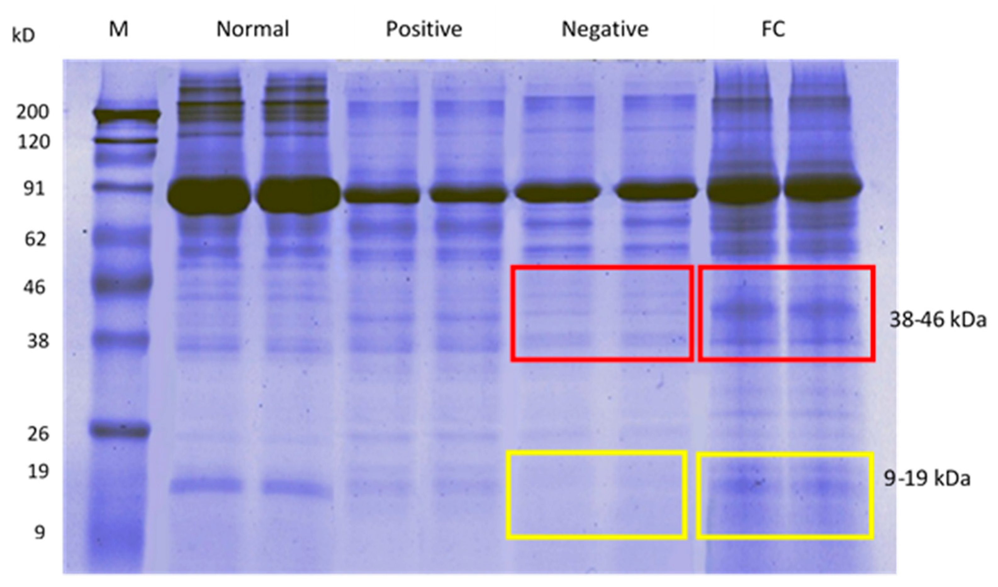 Processes 08 00395 g006 Processes 08 00395 g006