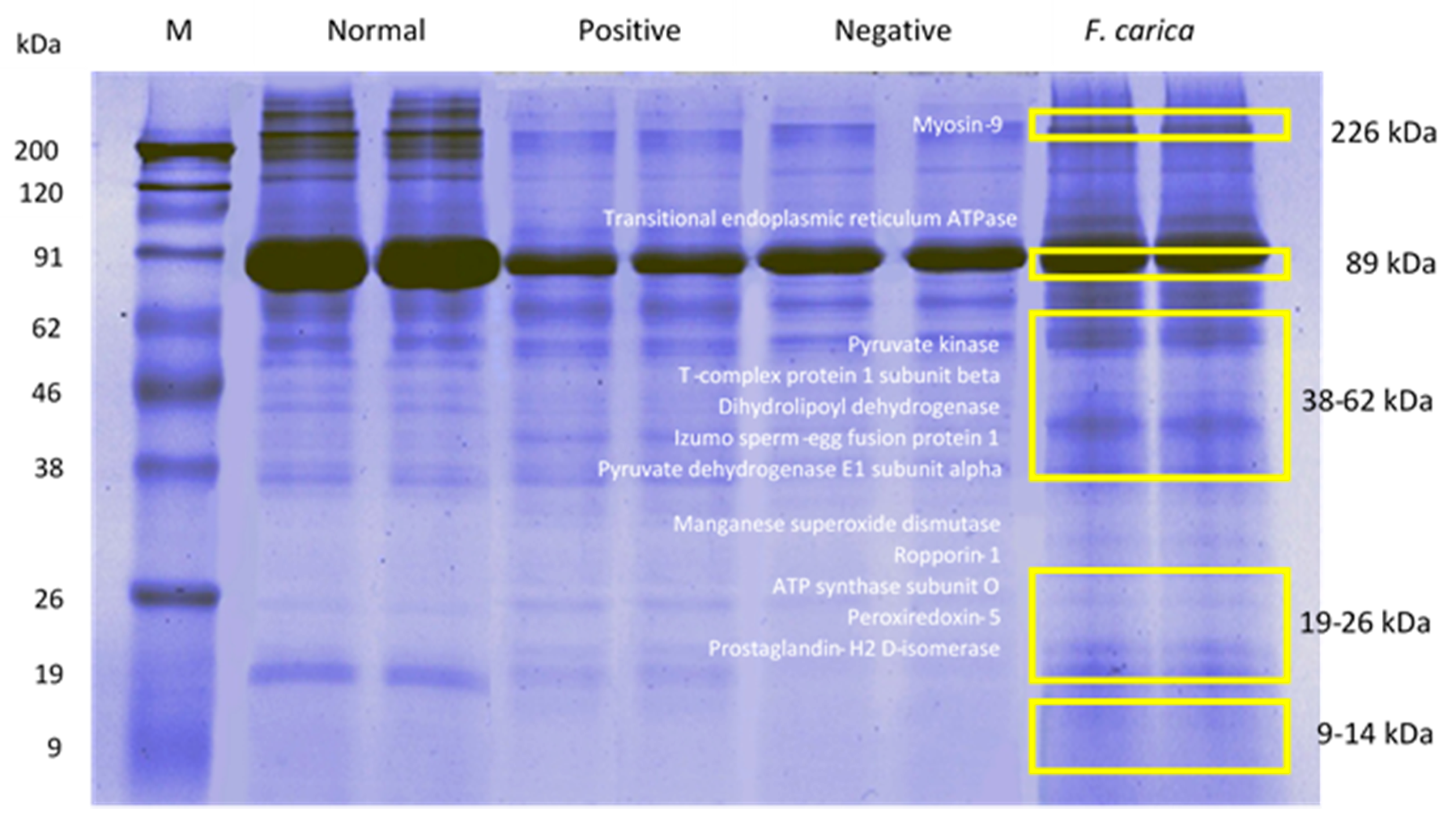 Processes 08 00395 g008 Processes 08 00395 g008