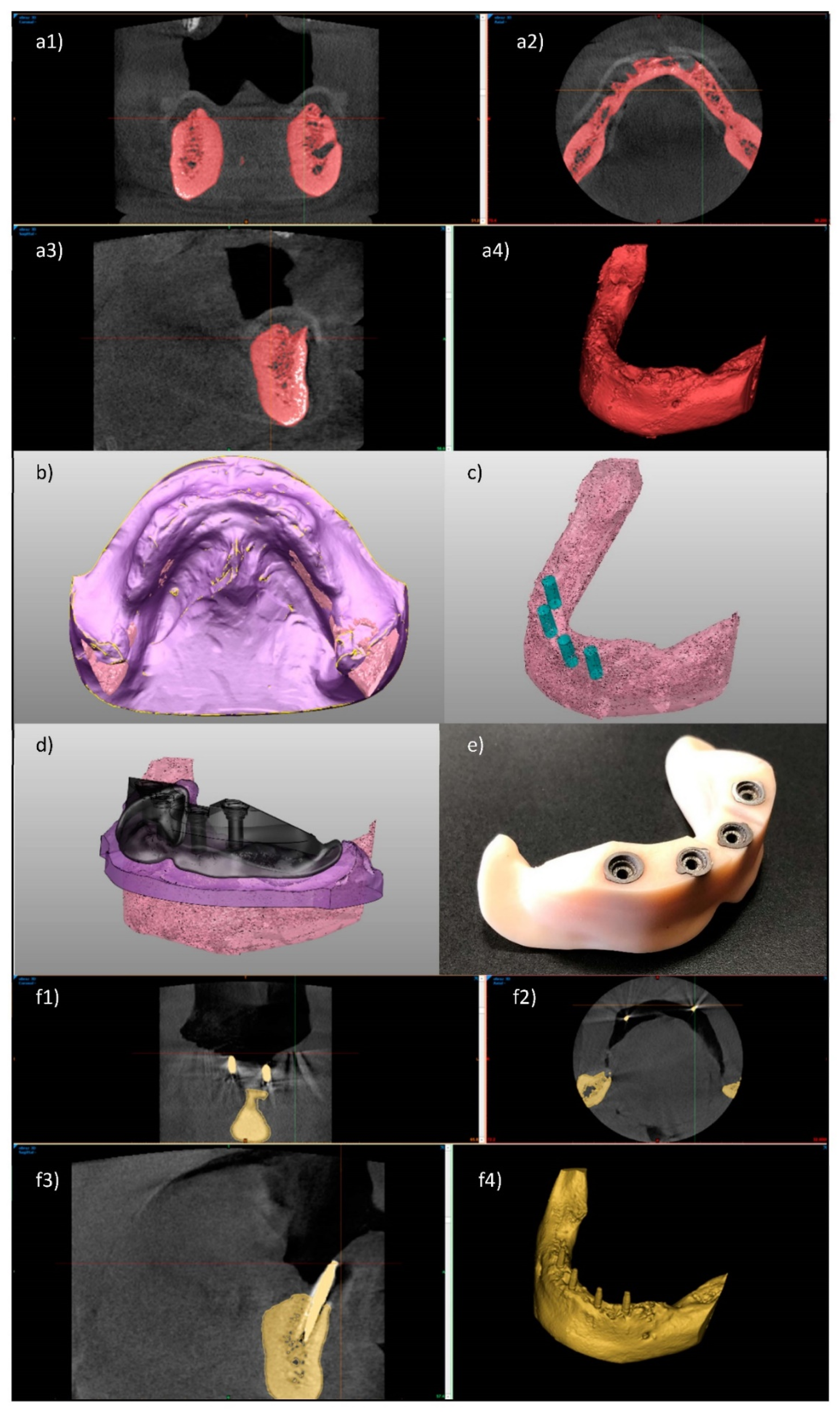 Processes 08 00525 g017 Processes 08 00525 g017