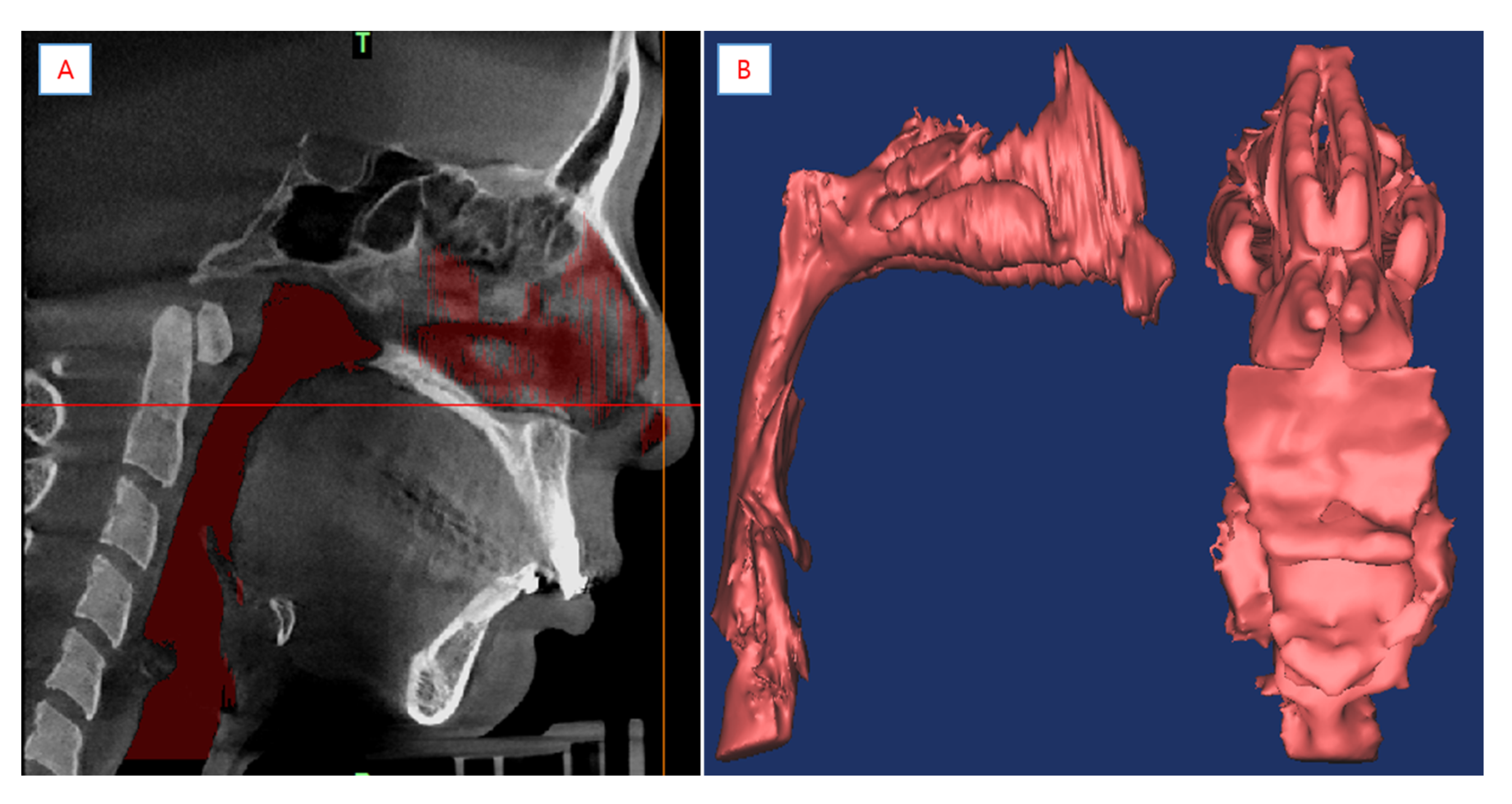 Processes 09 00152 g005