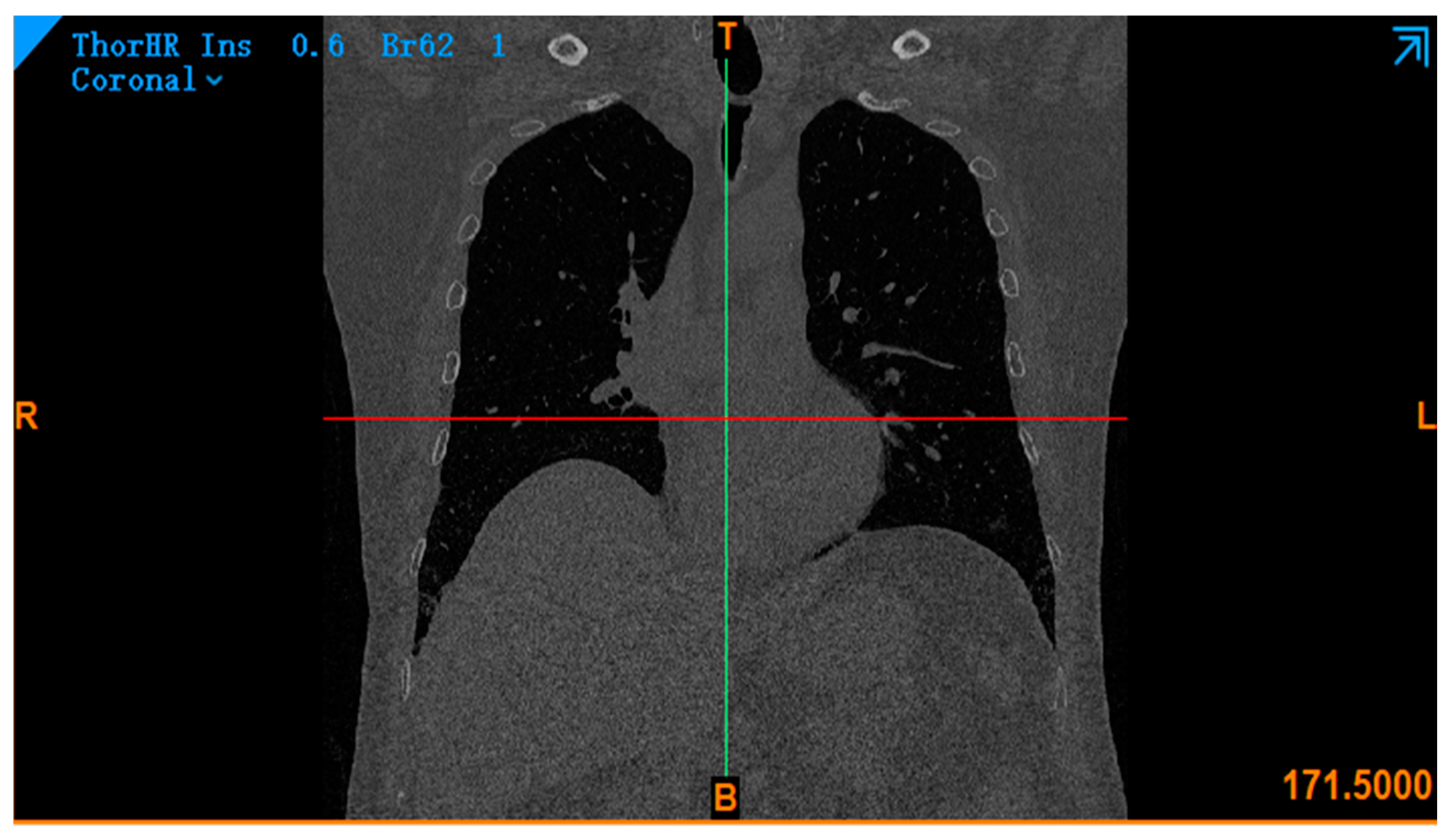 Processes 11 01281 g004