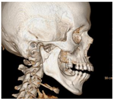 Processes 12 00406 i014