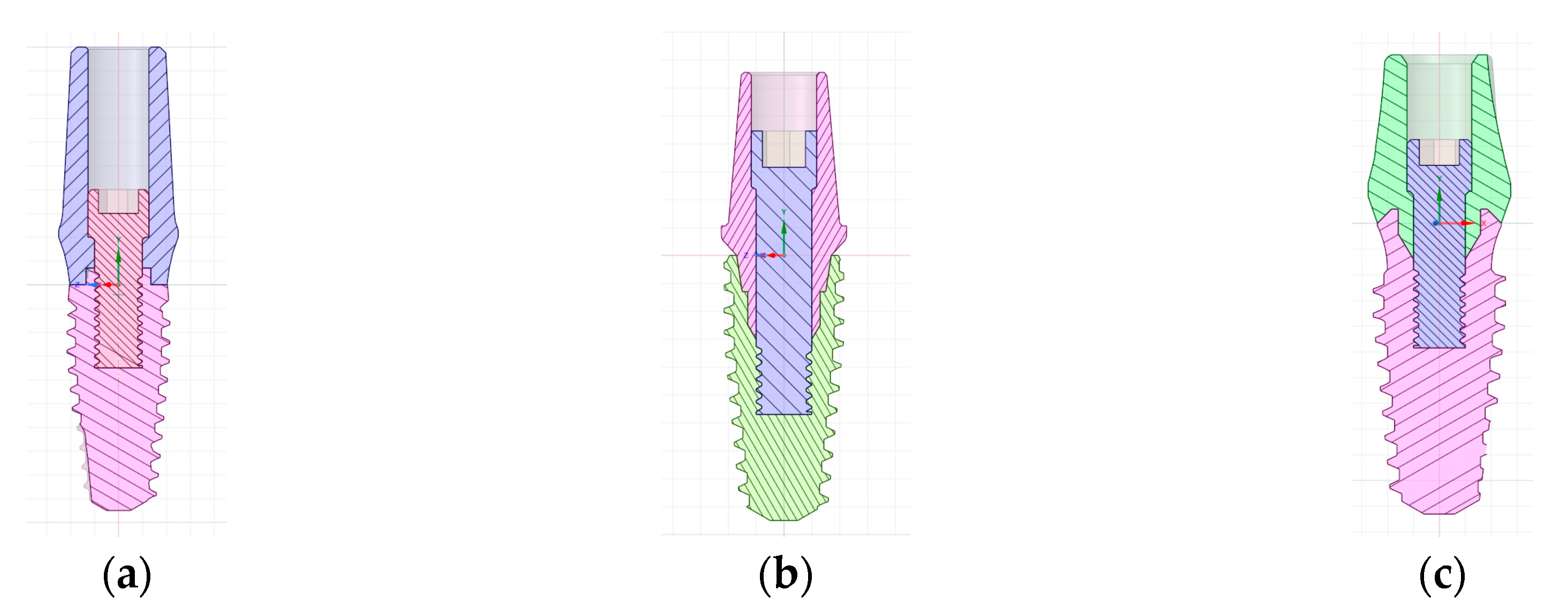 Prosthesis 01 00006 g009b