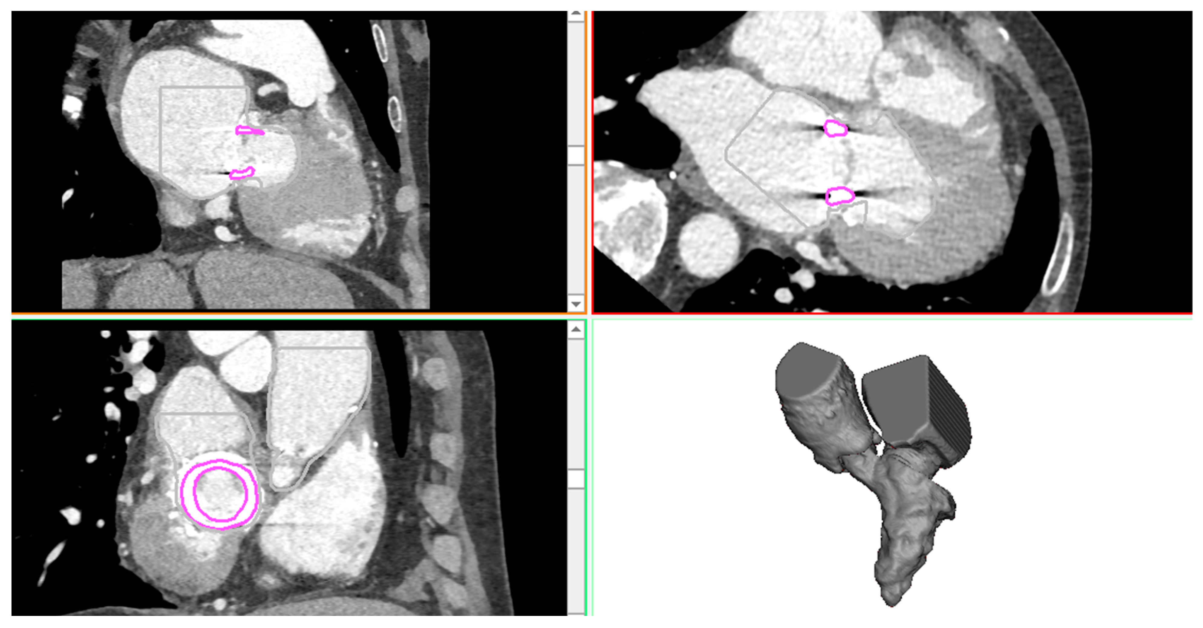 Prosthesis 02 00004 g001