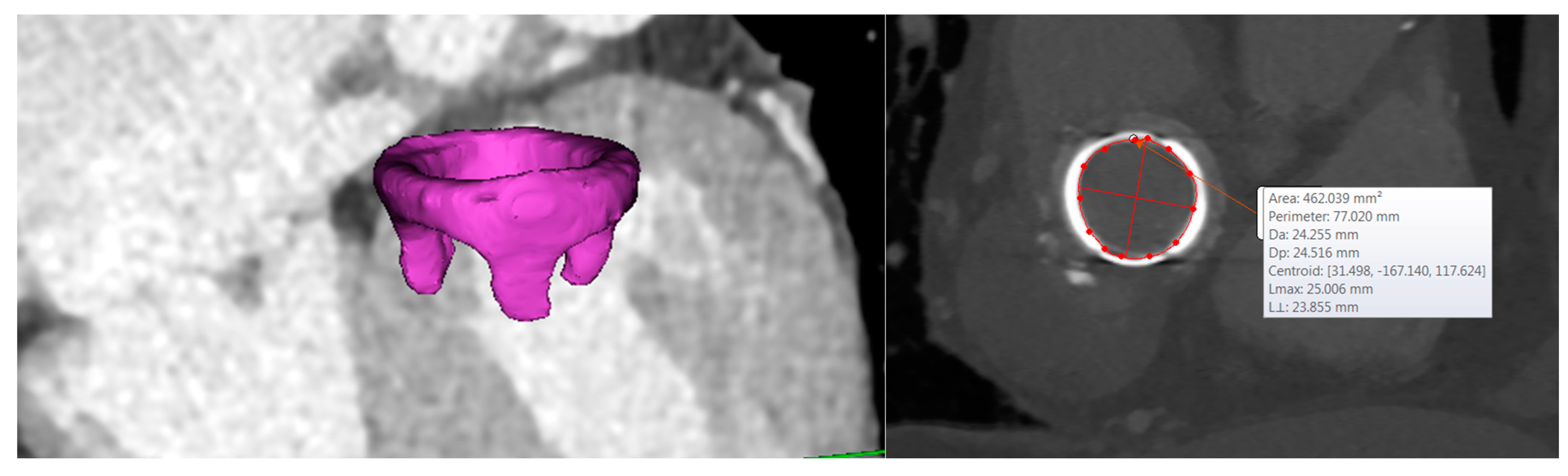 Prosthesis 02 00004 g002