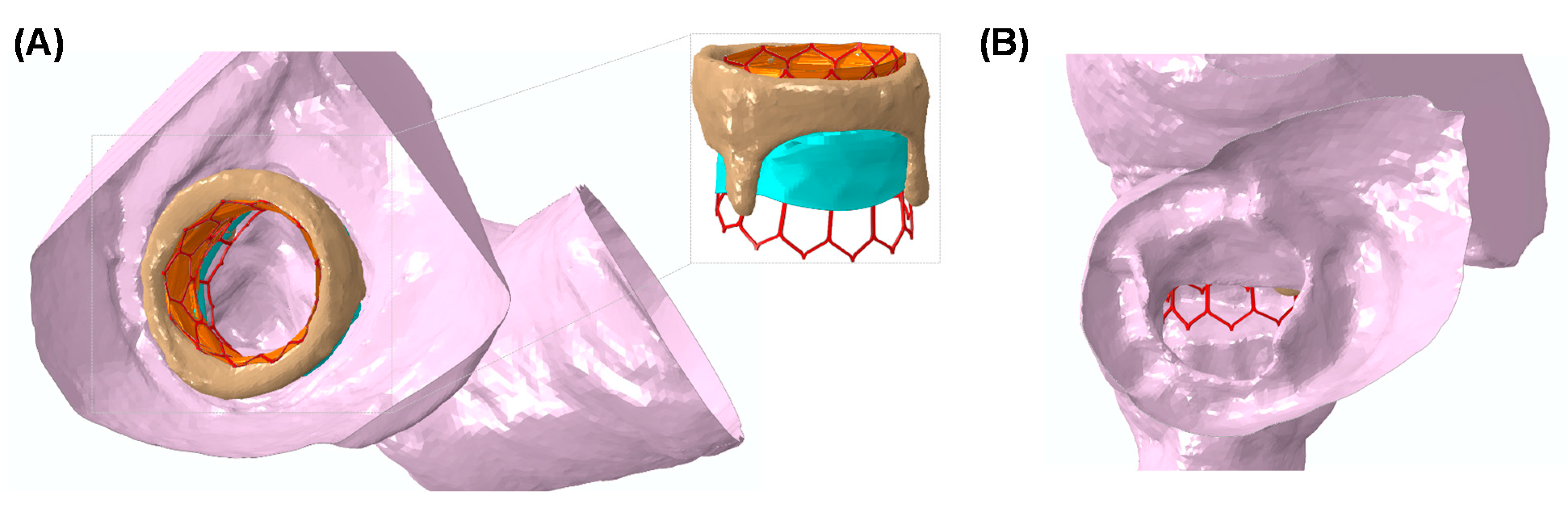 Prosthesis 02 00004 g004