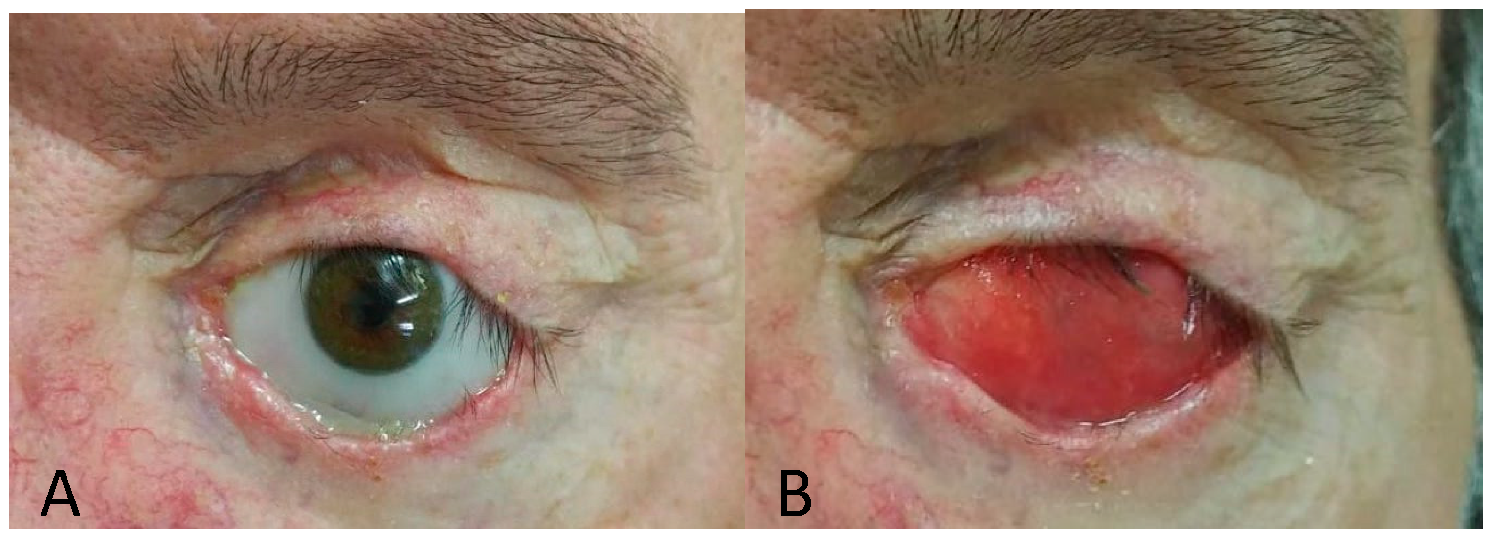 Prosthesis 02 00010 g001