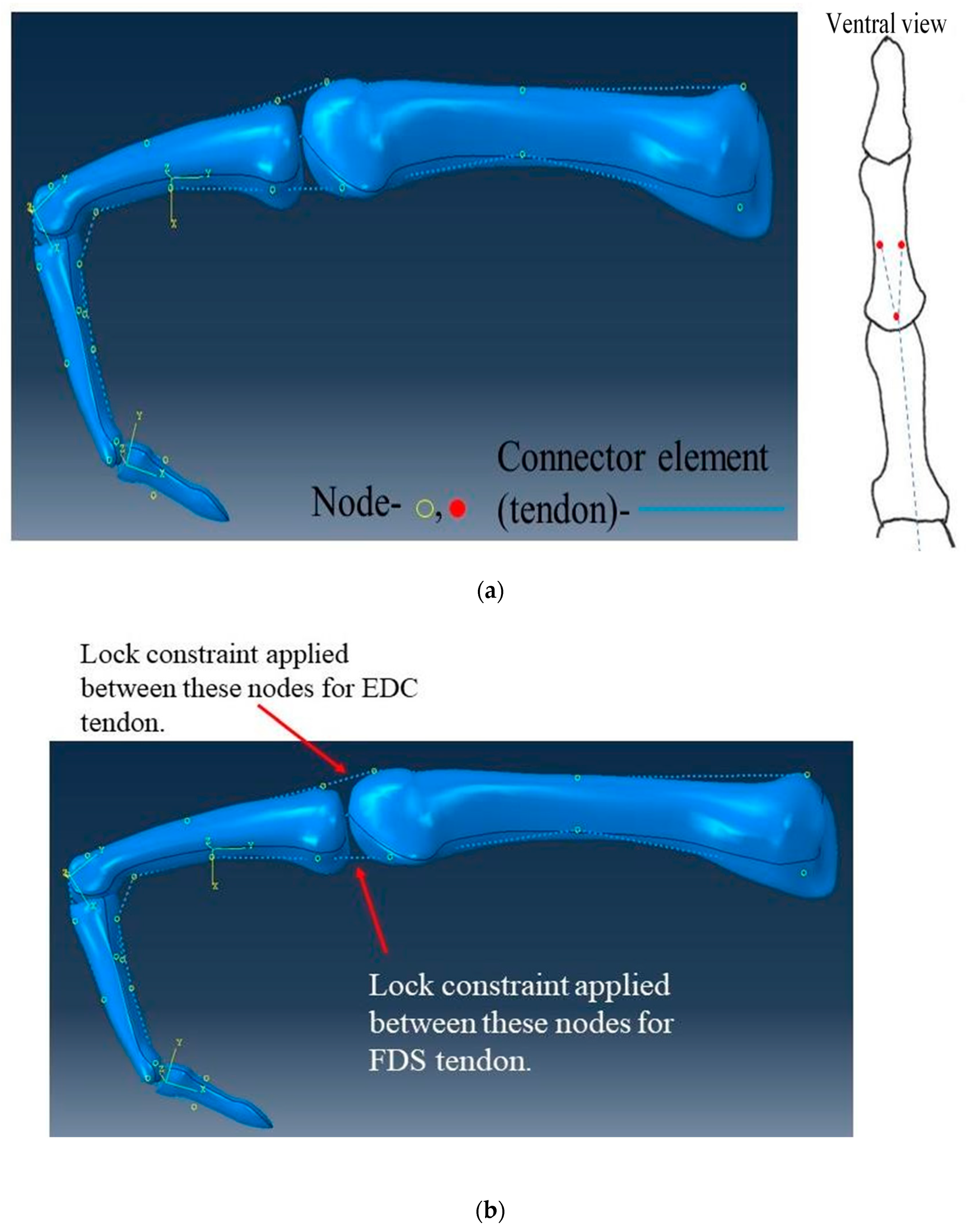 Prosthesis 02 00015 g012 Prosthesis 02 00015 g012