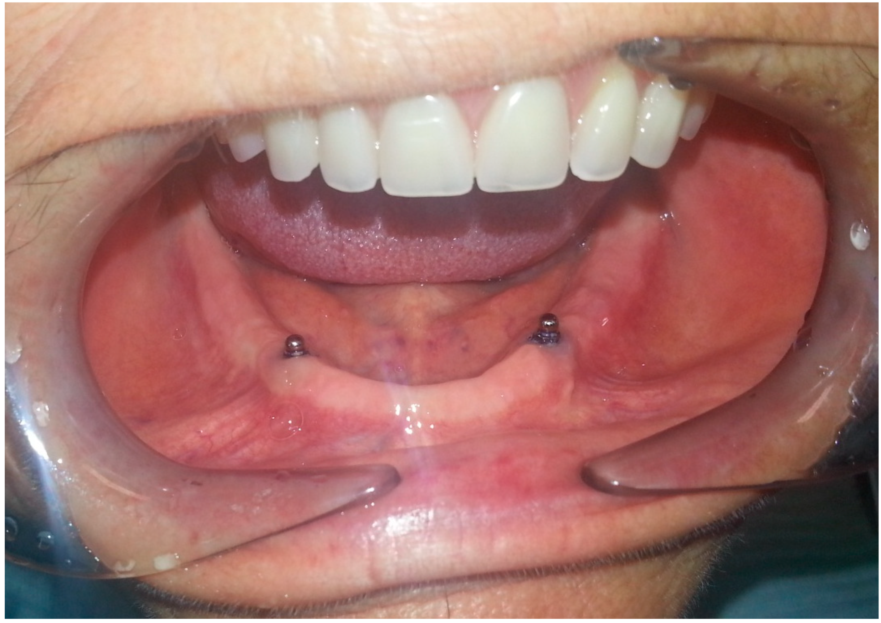 Prosthesis 02 00016 g001