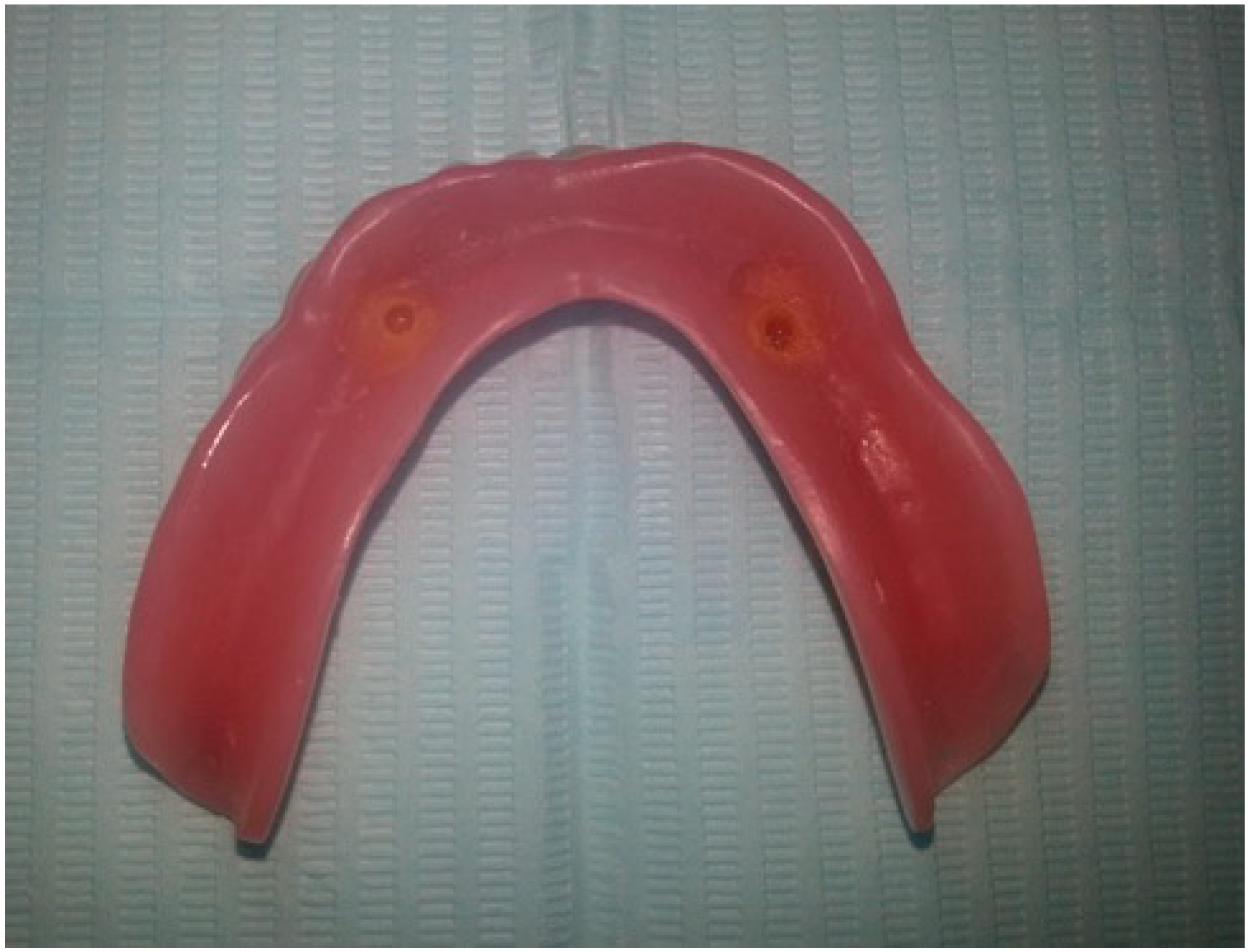 Prosthesis 02 00016 g003