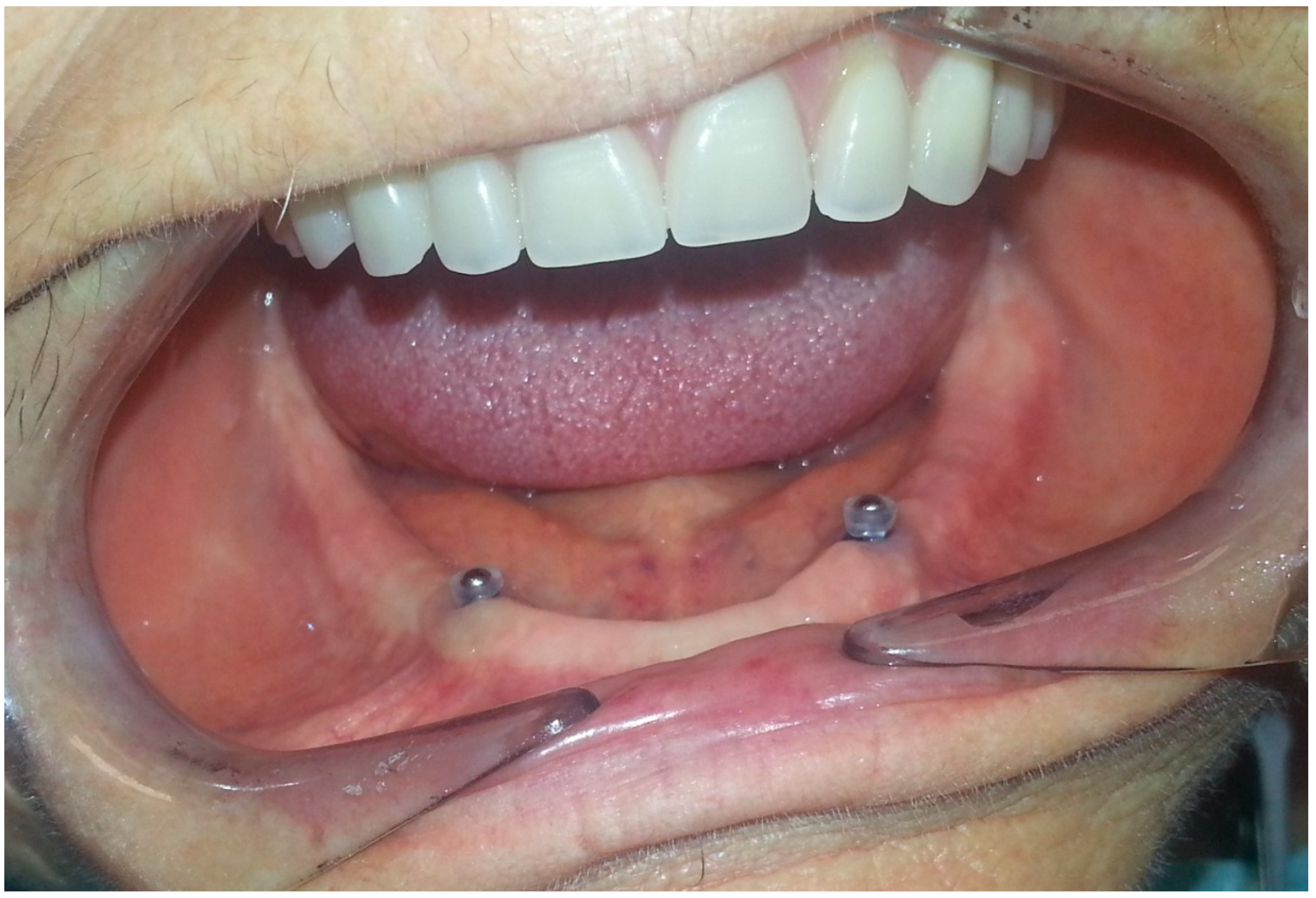 Prosthesis 02 00016 g005