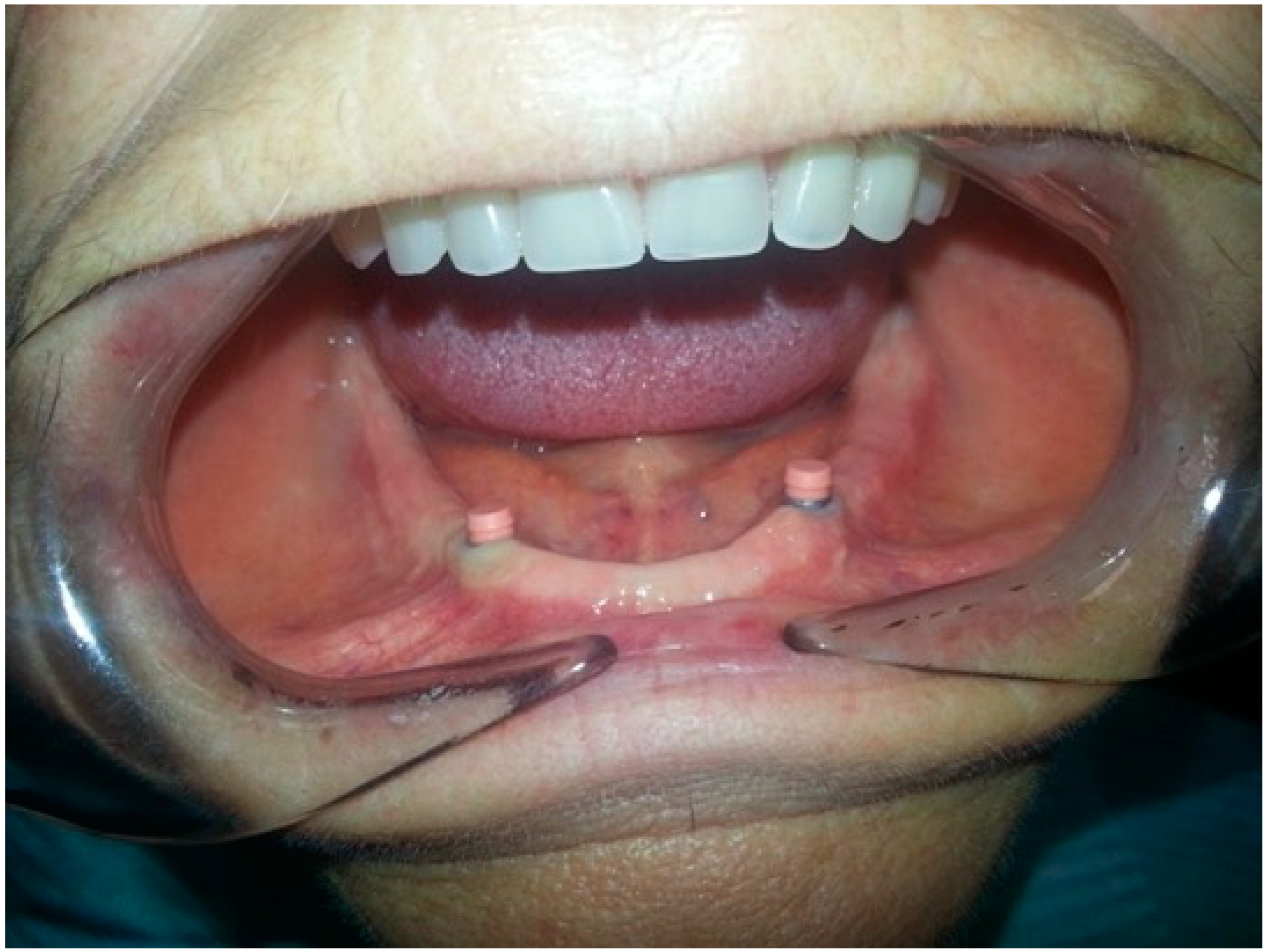 Prosthesis 02 00016 g006