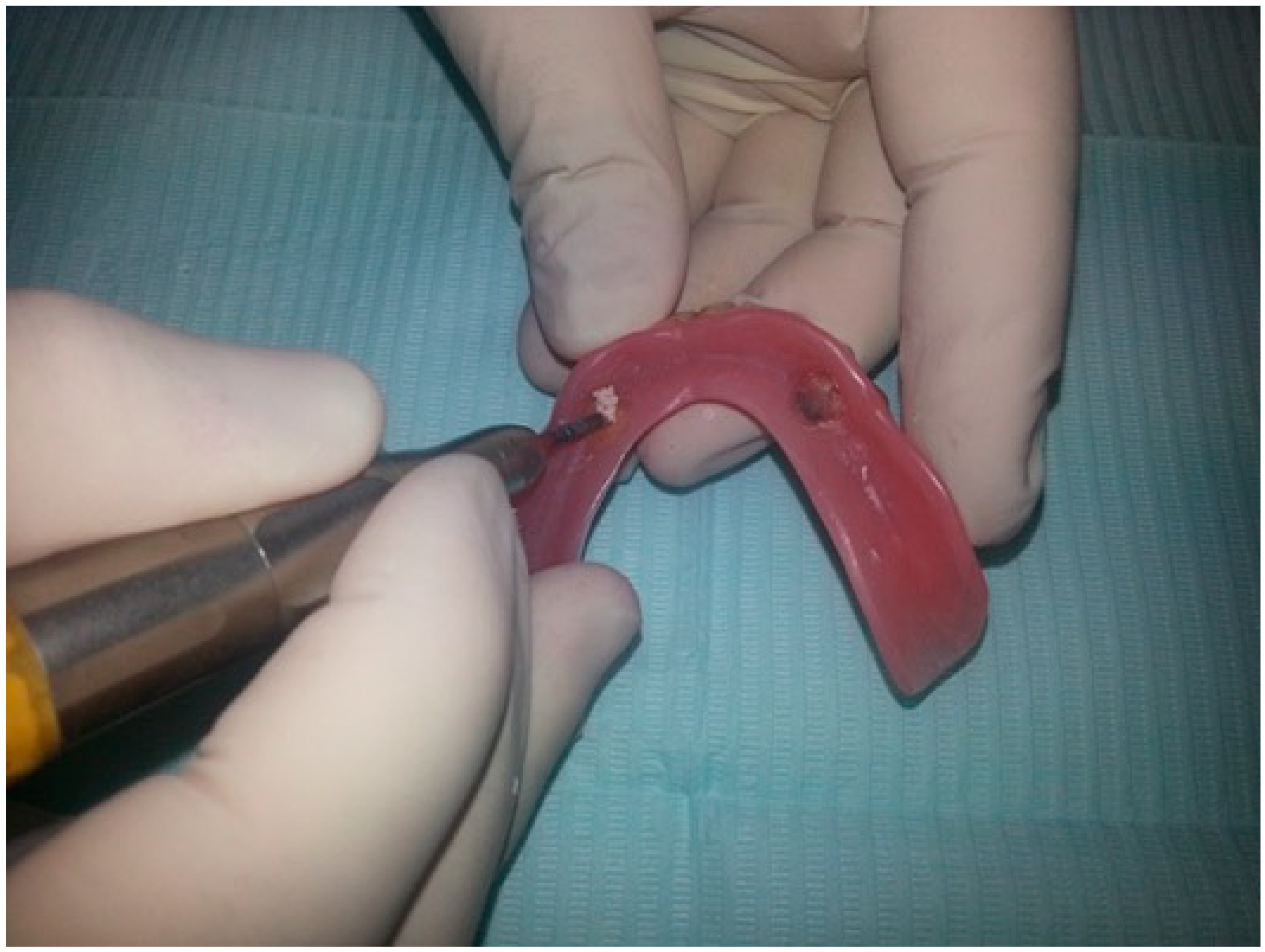 Prosthesis 02 00016 g007