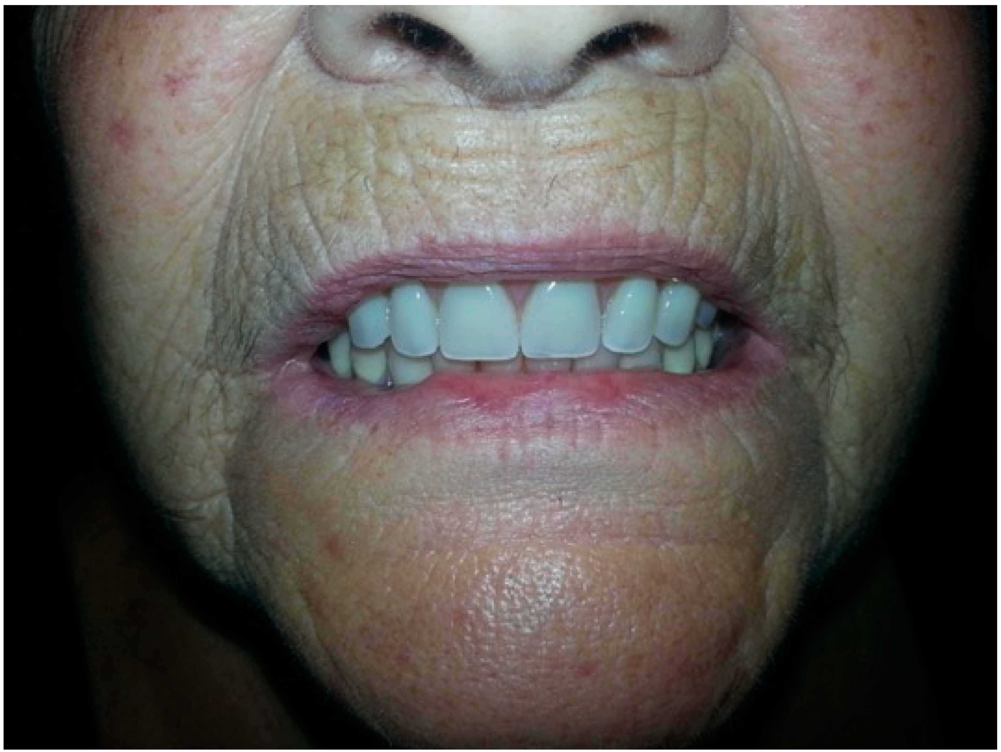 Prosthesis 02 00016 g010