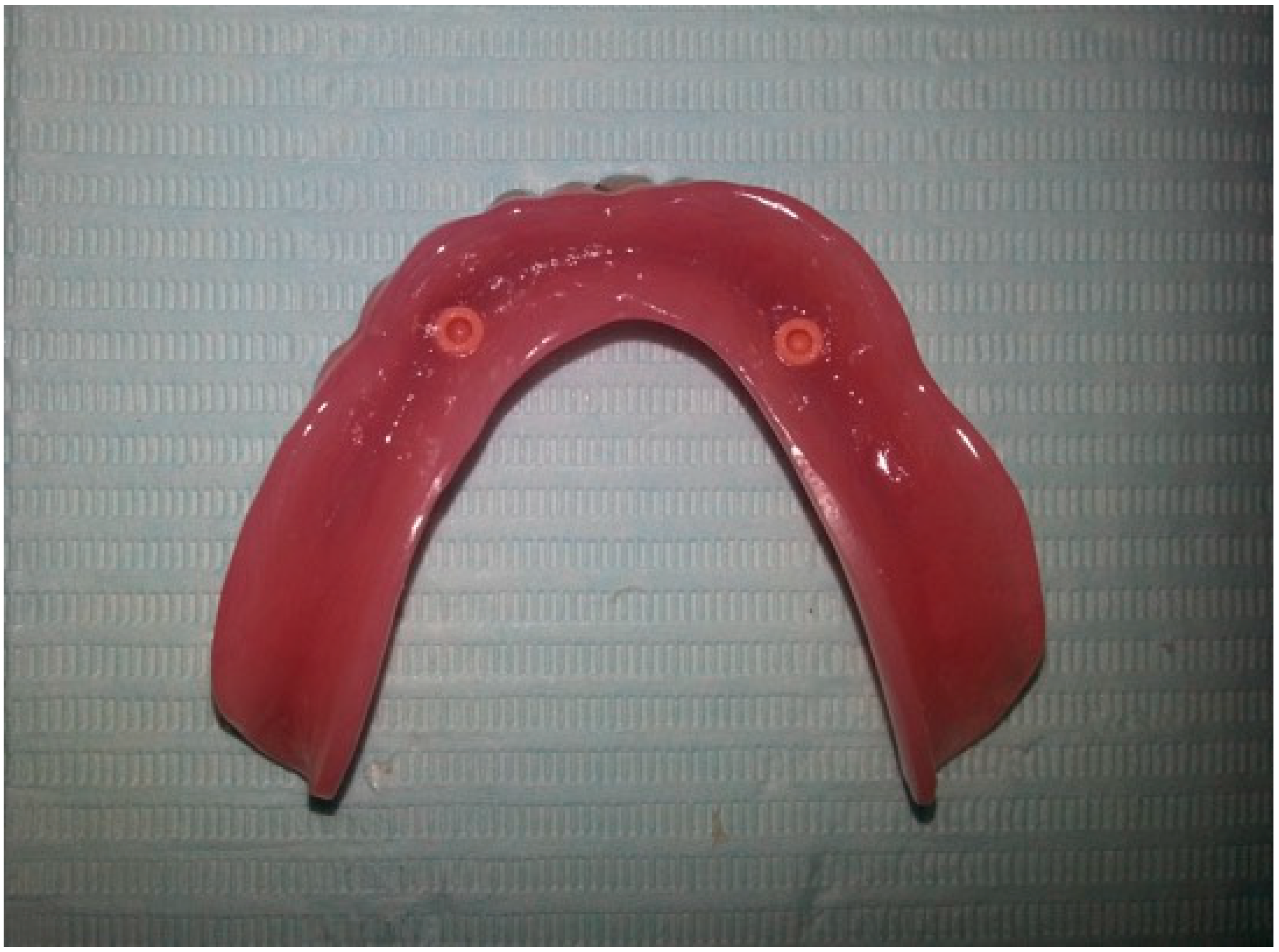 Prosthesis 02 00016 g011