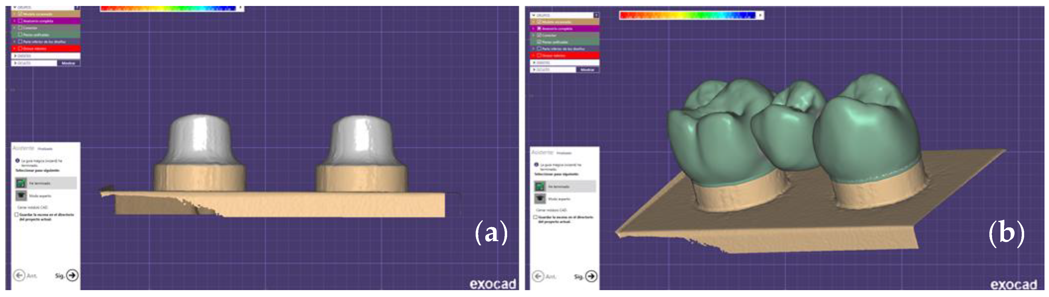 Prosthesis 02 00021 g001