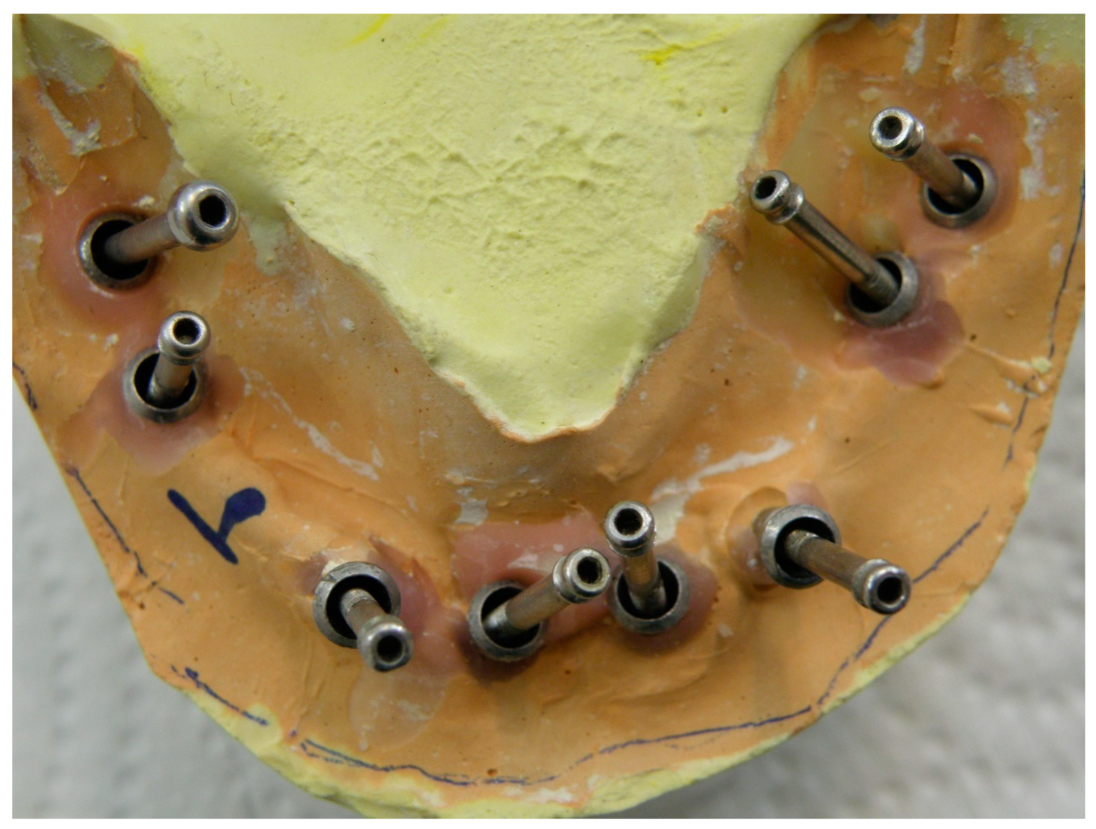 Prosthesis 02 00022 g001