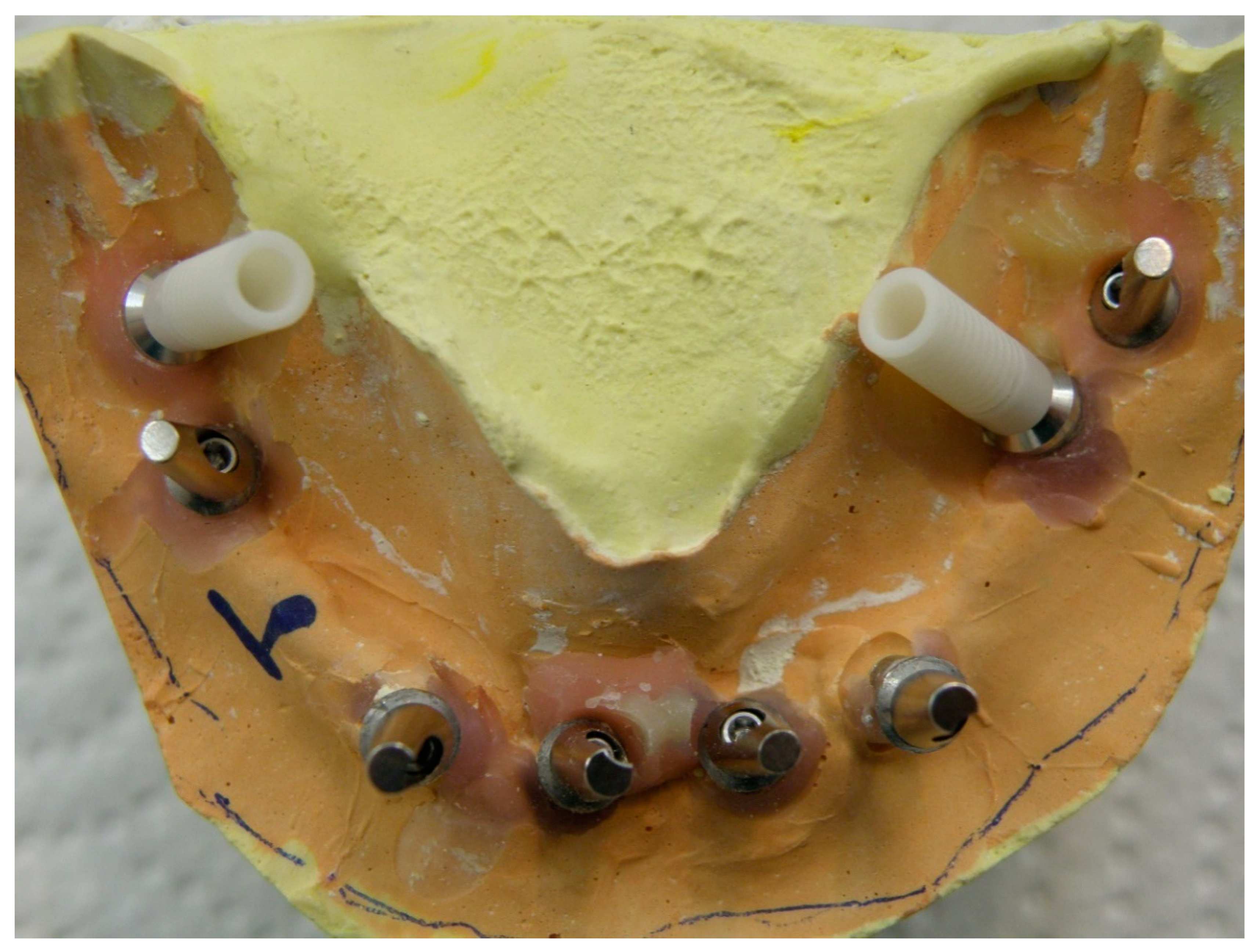 Prosthesis 02 00022 g002