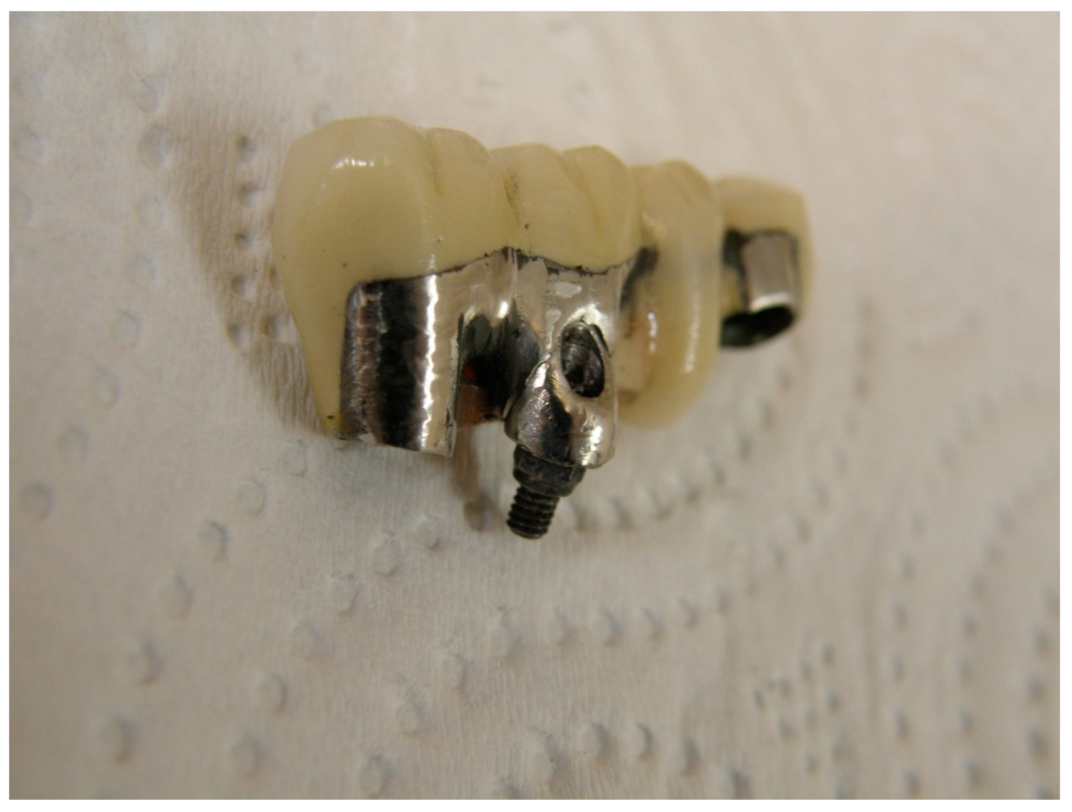 Prosthesis 02 00022 g005