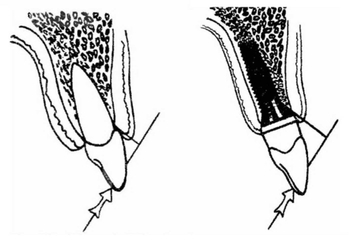 Prosthesis 02 00023 g001