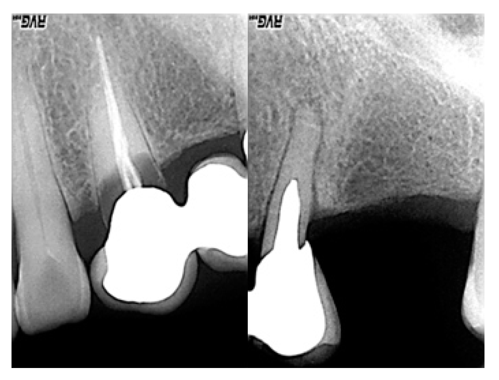 Prosthesis 02 00023 g004