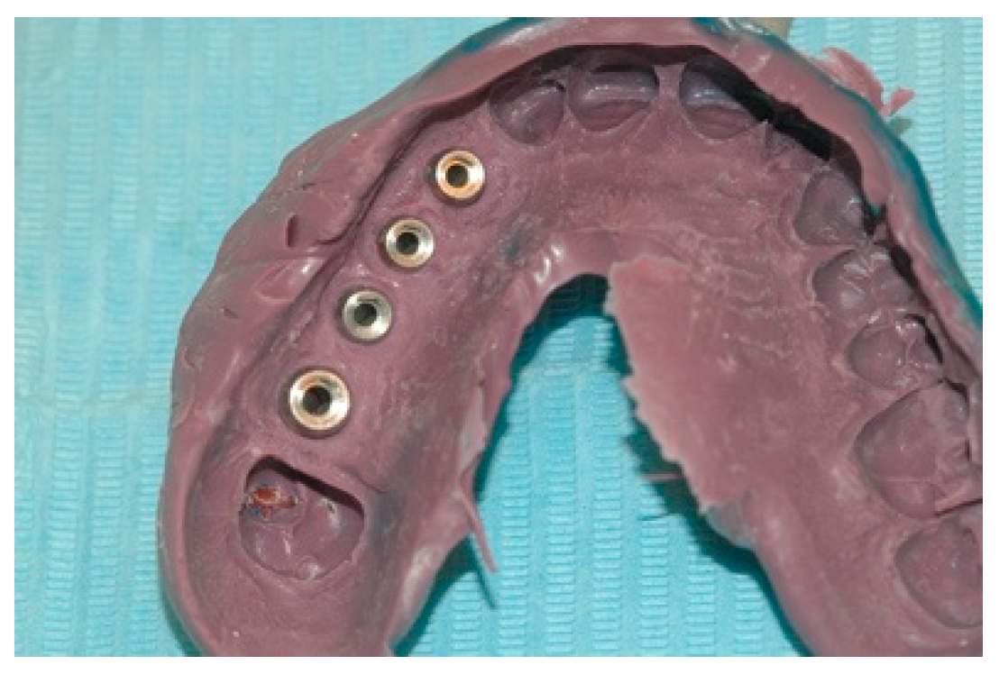 Prosthesis 02 00023 g005