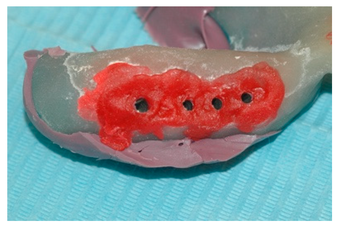 Prosthesis 02 00023 g006