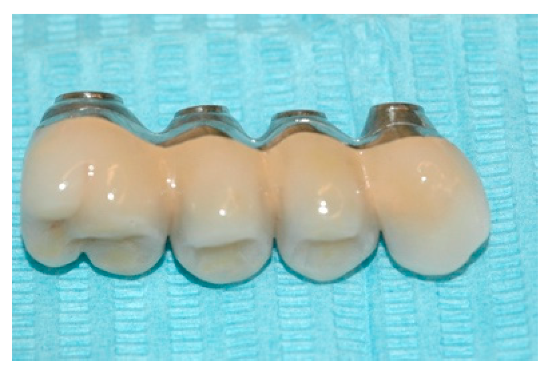 Prosthesis 02 00023 g011