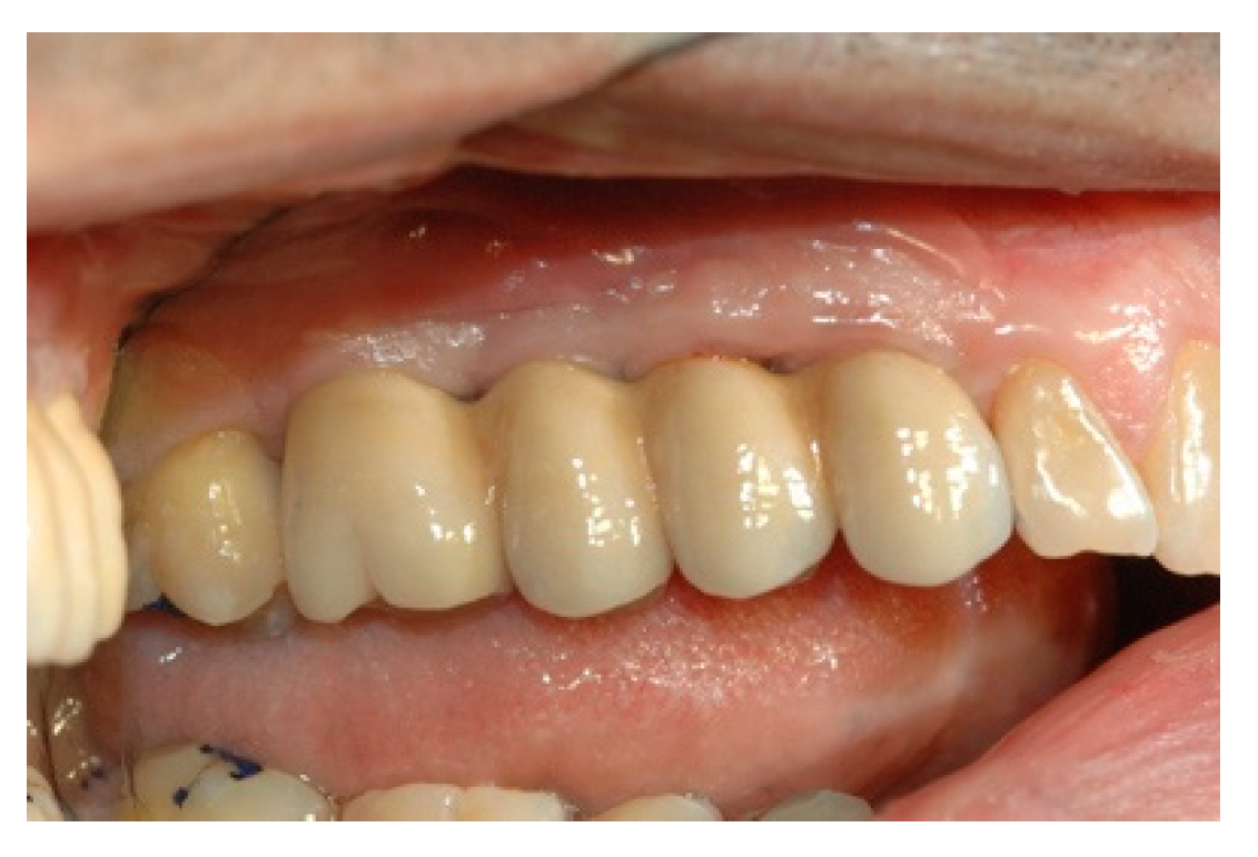 Prosthesis 02 00023 g012