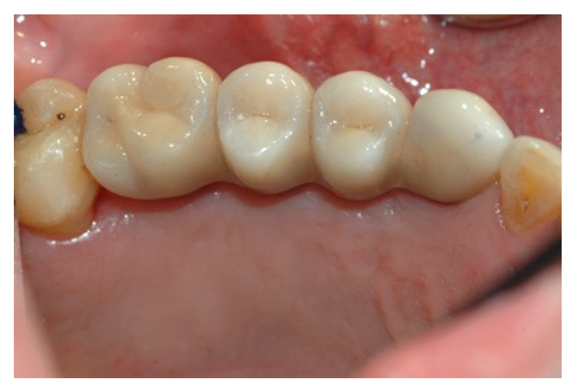 Prosthesis 02 00023 g014