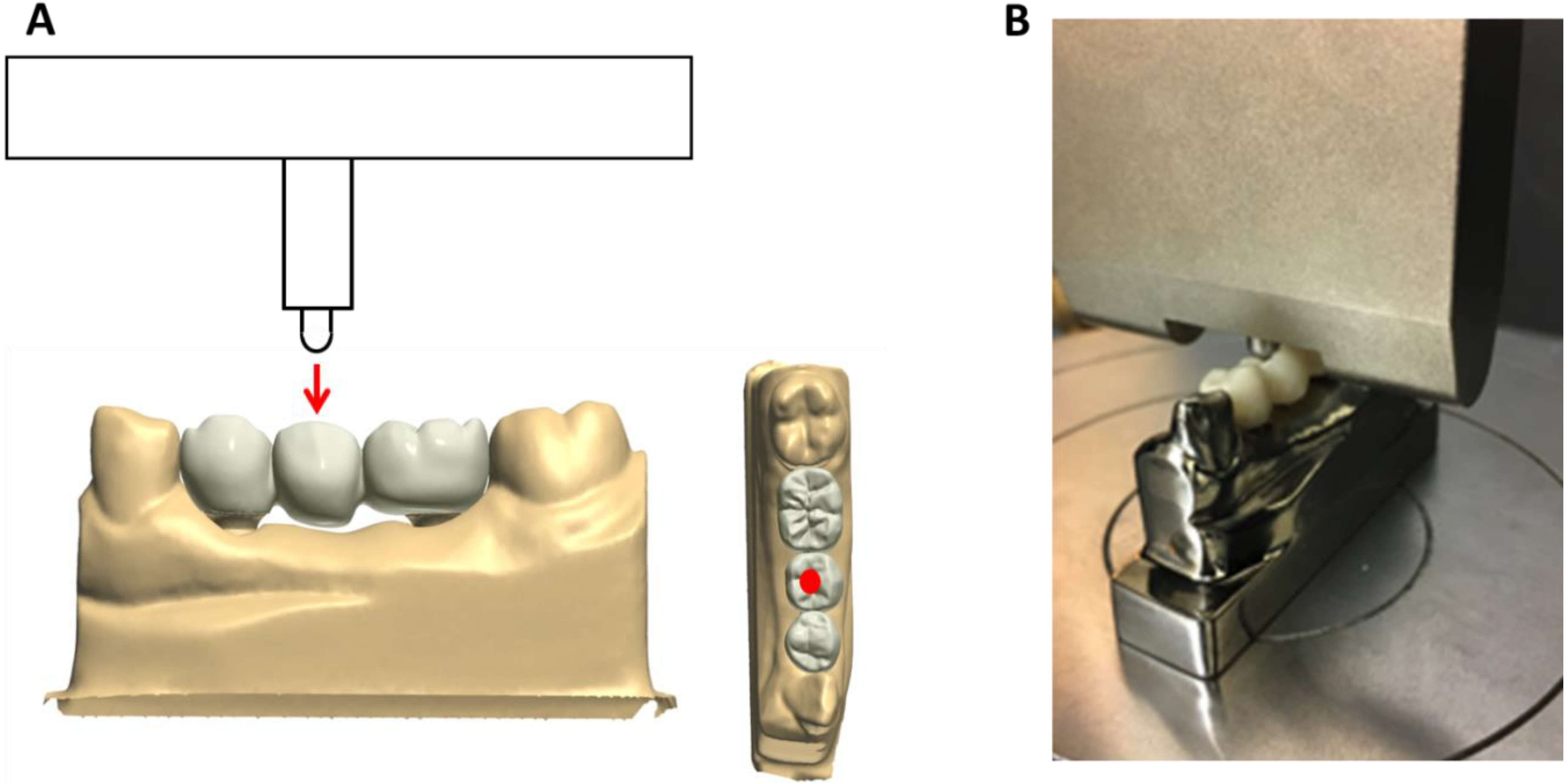 Prosthesis 02 00030 g002
