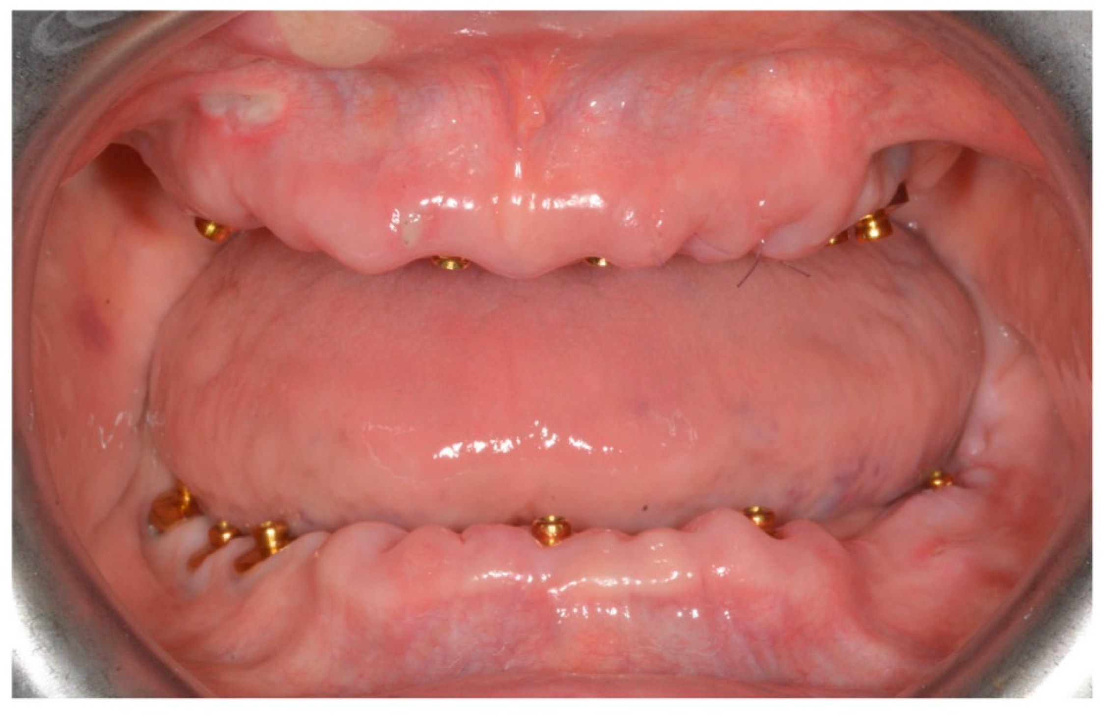 Prosthesis 02 00033 g001