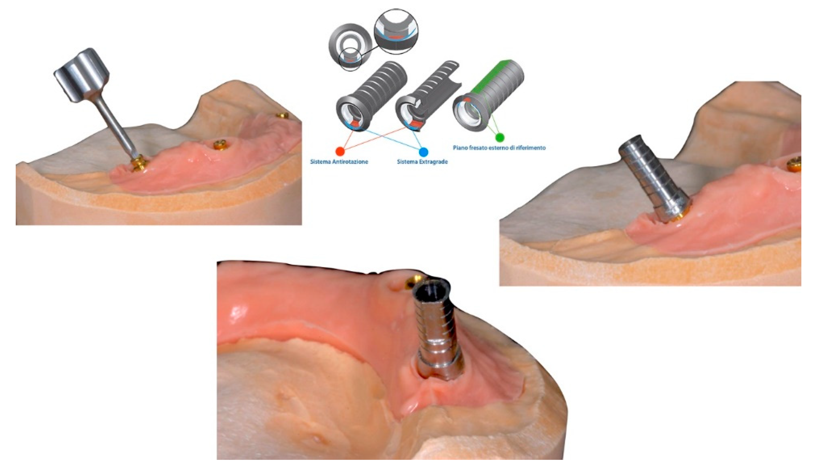 Prosthesis 02 00033 g002